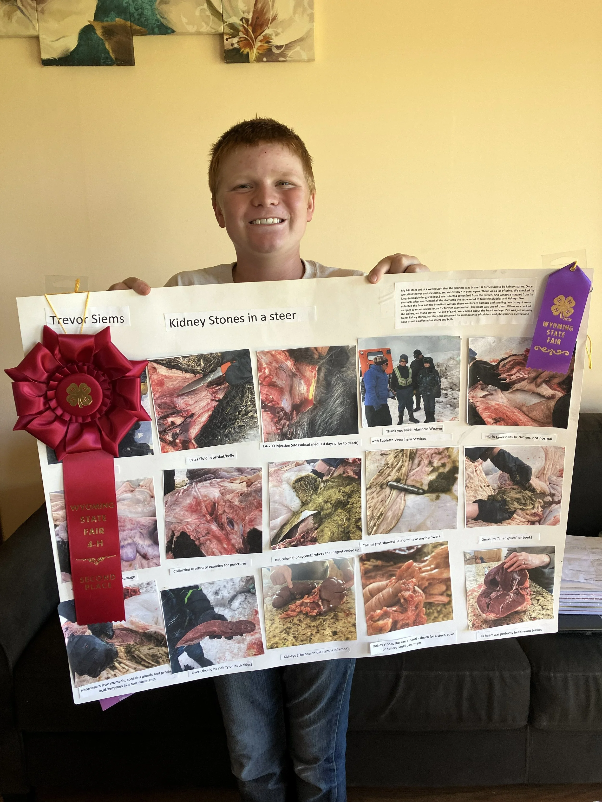 A boy holding a science project poster about kidney stones and urinary health, with a large red ribbon indicating second place at a Wyoming State Fair.