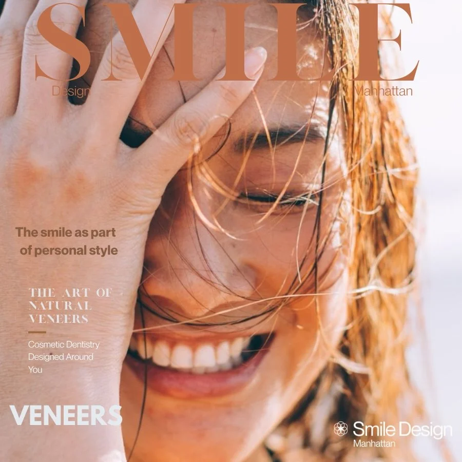 Veneers
