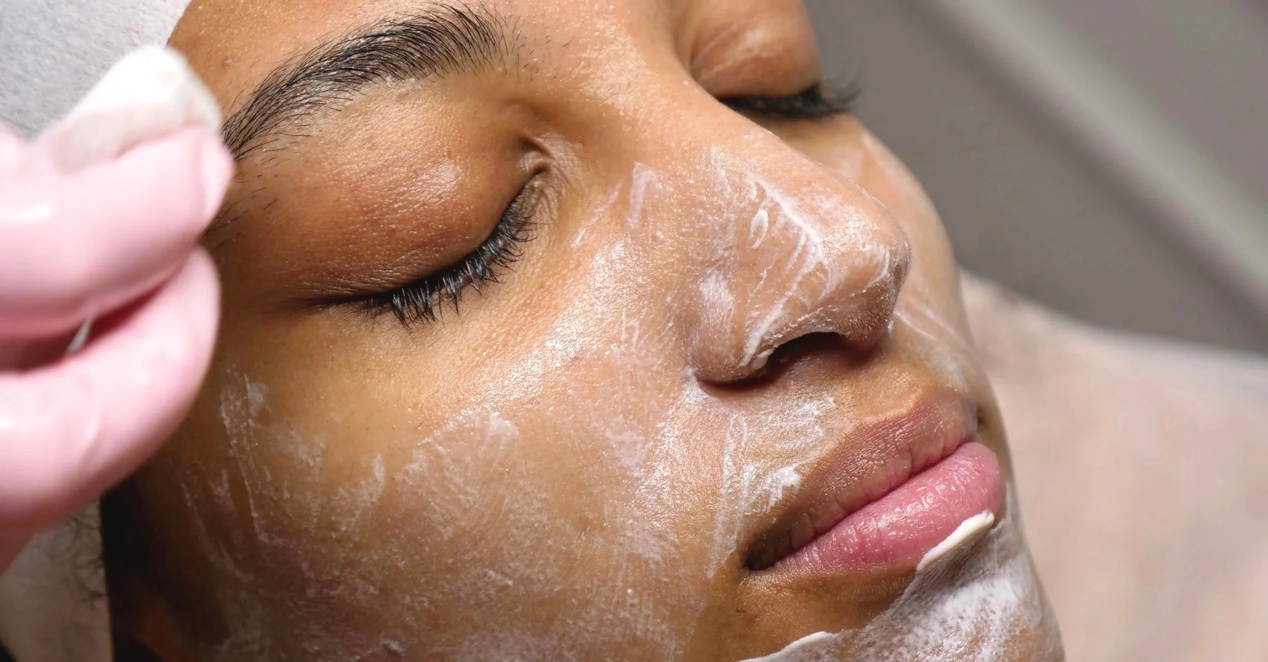 Close-up of a woman's face with eyes closed as a skincare professional applies a facial treatment using a brush, with a white cream or mask on her face.