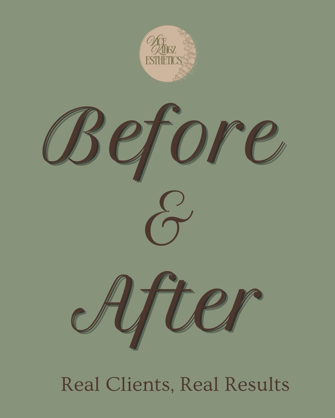 A real result from a real client who did a custom facial! If you&rsquo;re jealous, you can be next!! 
.
.
.
#murrieta #vicekingzesthetics #murrietaesthetician