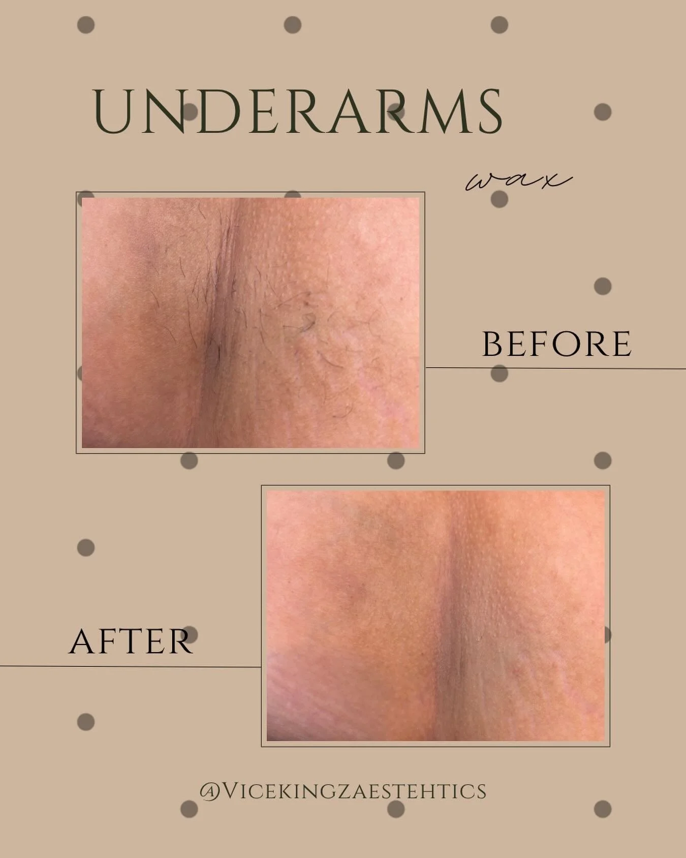 Smooth, clean, and confident ✨

A fresh underarm wax leaves the skin feeling silky while removing unwanted hair from the root for longer-lasting smoothness.

Ready to ditch the razor? Book your next wax with us 🤎

#ViceKingzEsthetics #SmoothSkin #Es