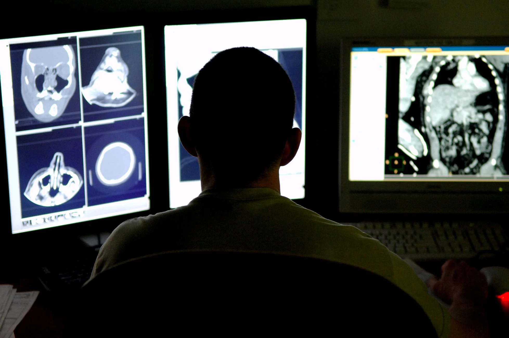 Person studying medical scans on multiple computer screens in a dark room.