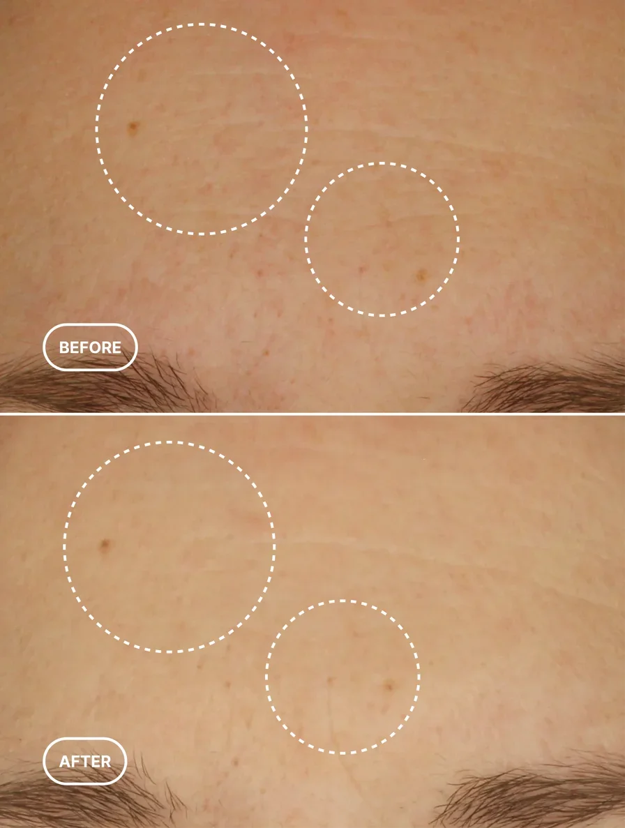 Retinol Alternative Serum1.webp