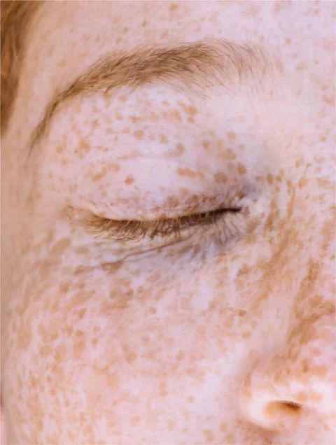 Vitamin C Serum3.webp