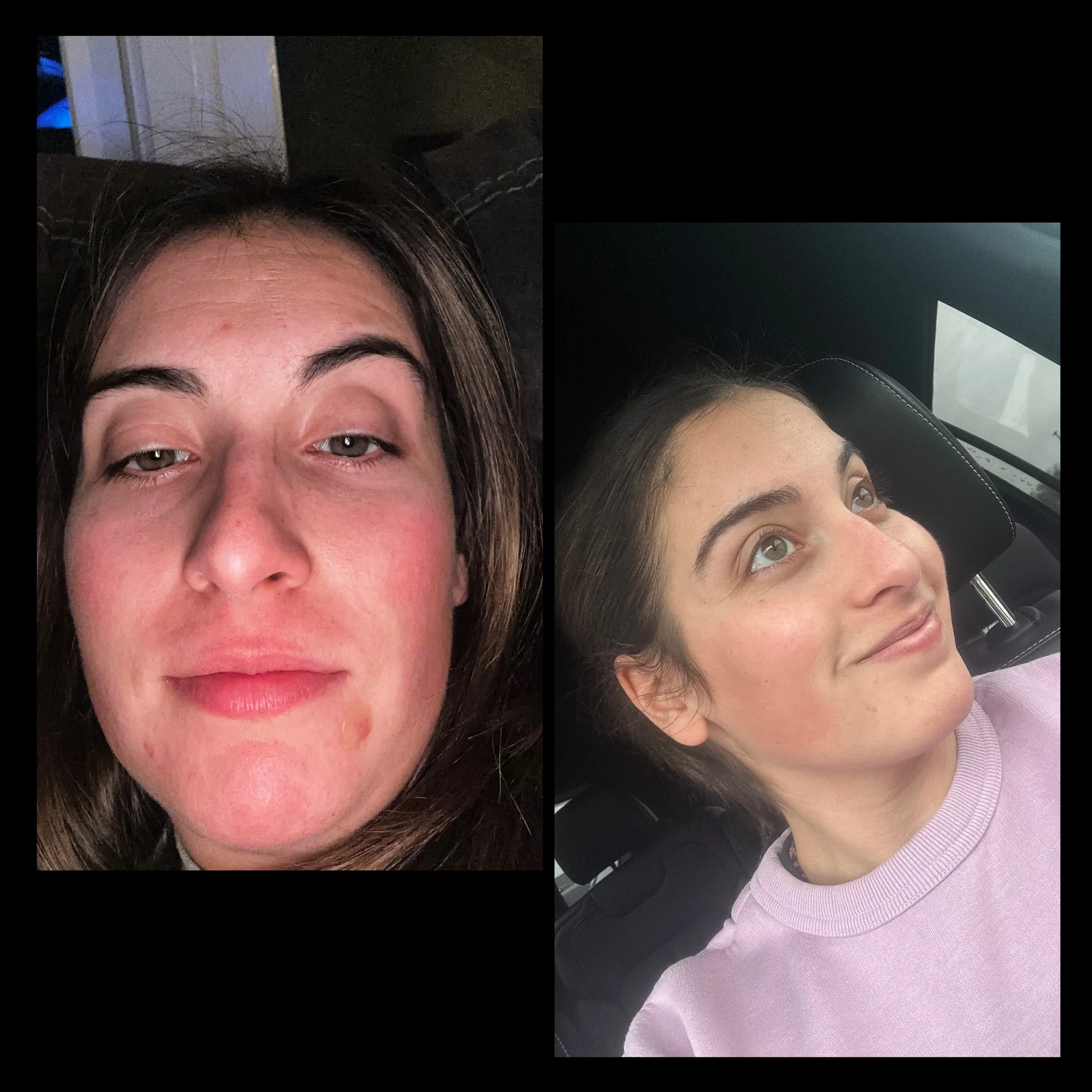 A collage of close-up photos of two women's faces, showing their foreheads and eyes, one with light skin and brown hair, the other with darker skin and black hair, taken at different angles inside a car.