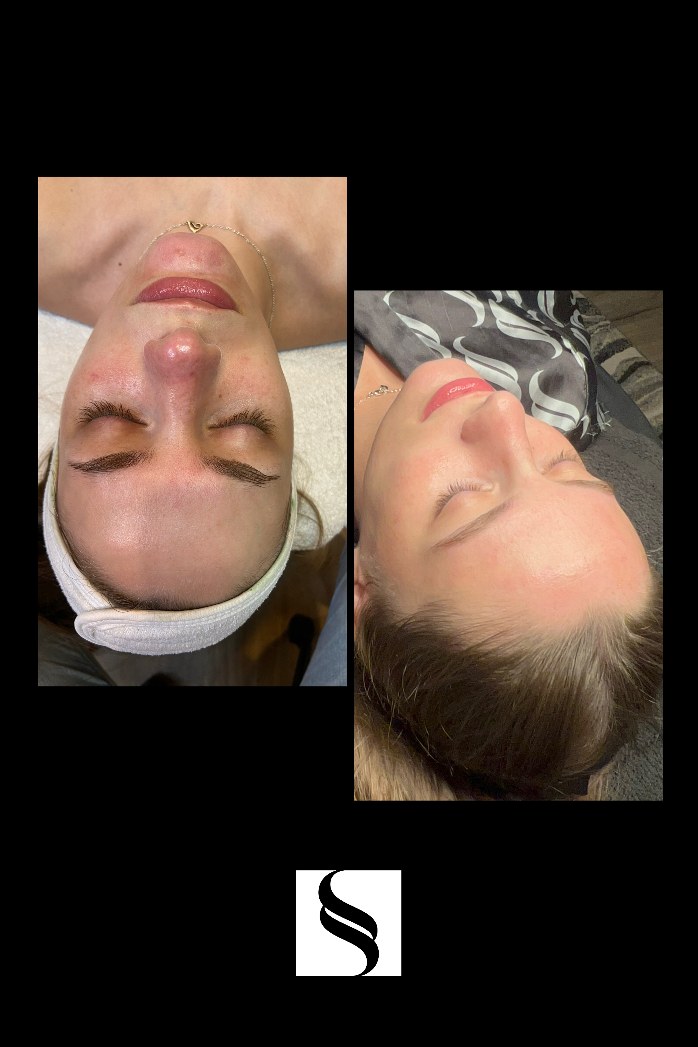 Images showing close-up views of a woman's face during a facial treatment, with her eyes closed, looking relaxed. One image features her lying on a treatment bed with a headband, and the other shows her from a side angle wearing a patterned shirt. Th