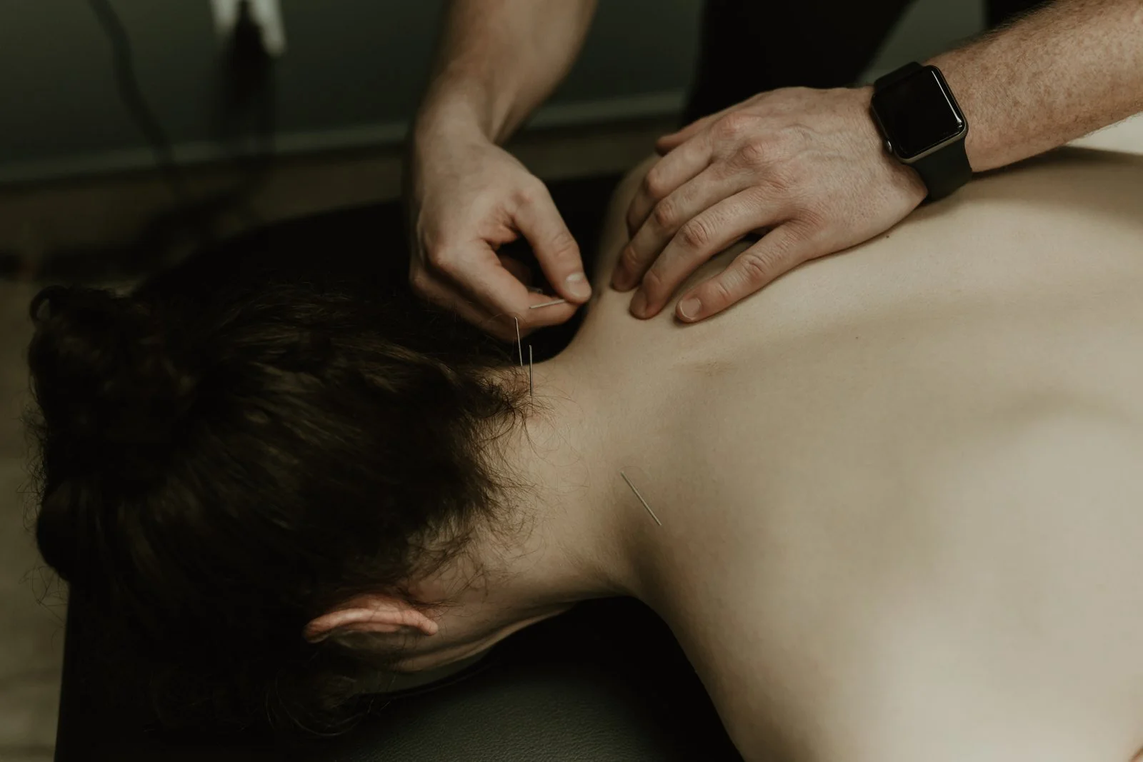 Fine-needle treatment being provided in the Stride chiropractic clinic