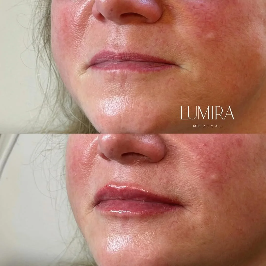 Natural-looking medical aesthetics treatment results.