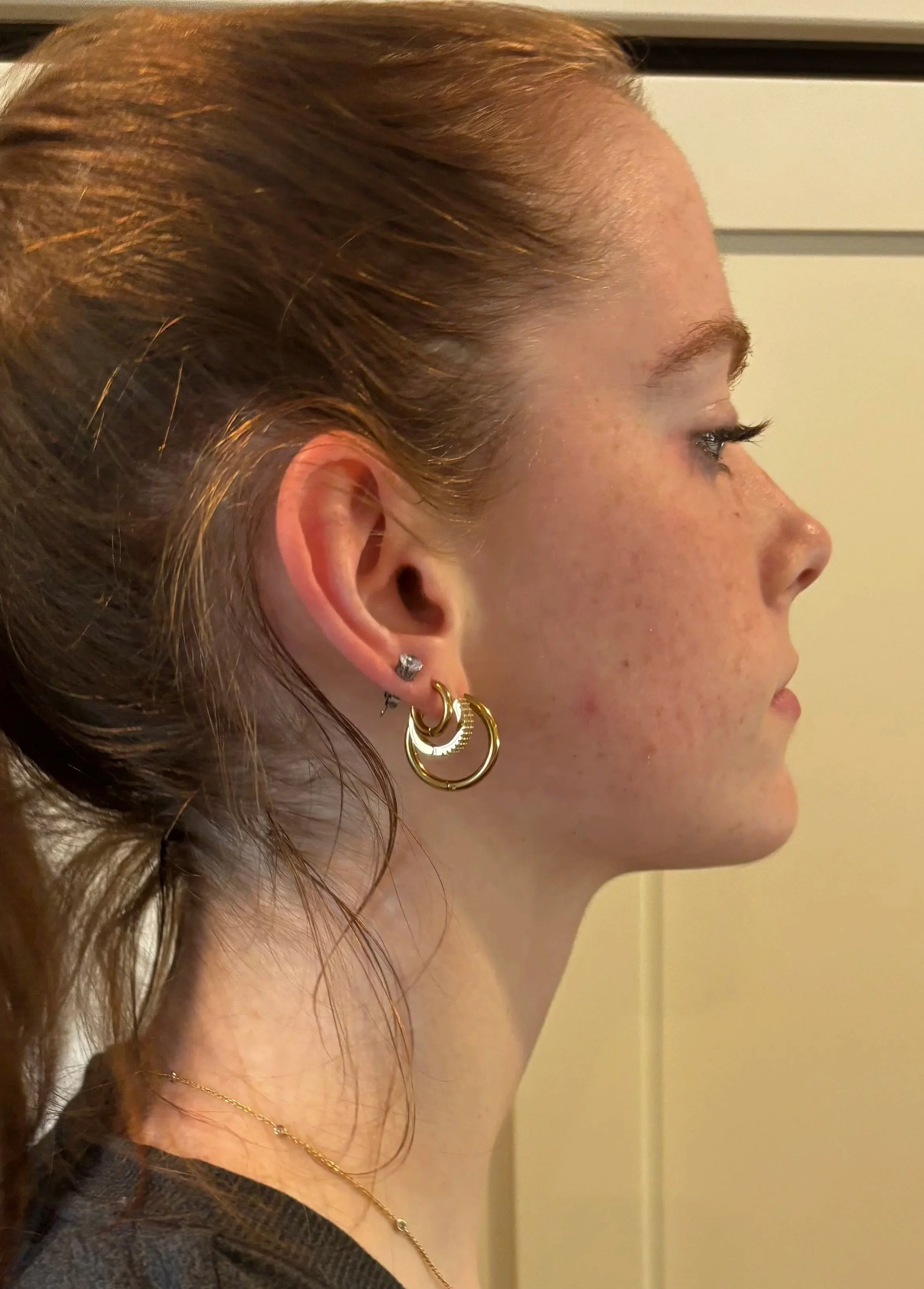 BEFORE: Basic FX - Dirt