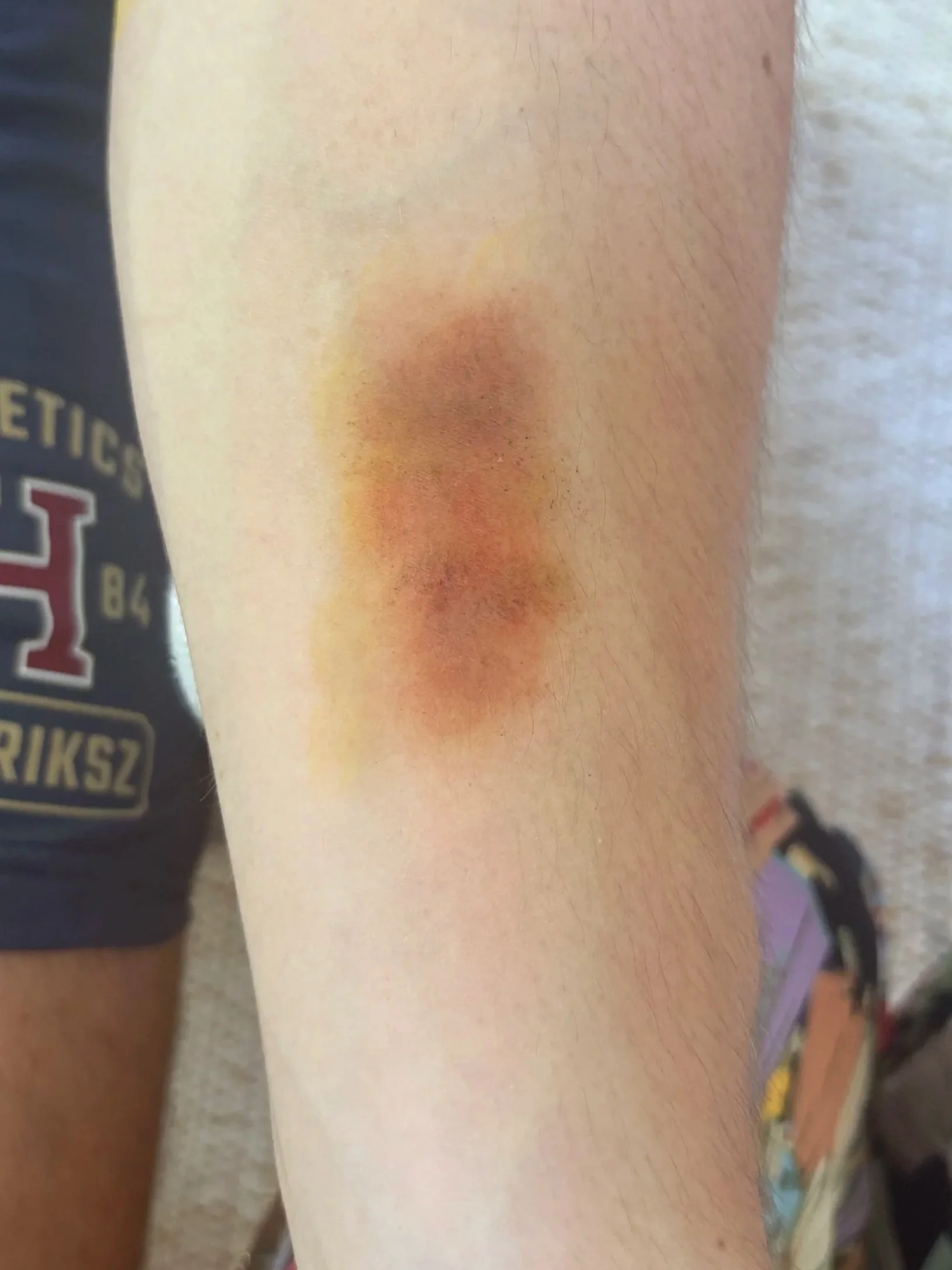 PROCESS: Basic FX - Bruise