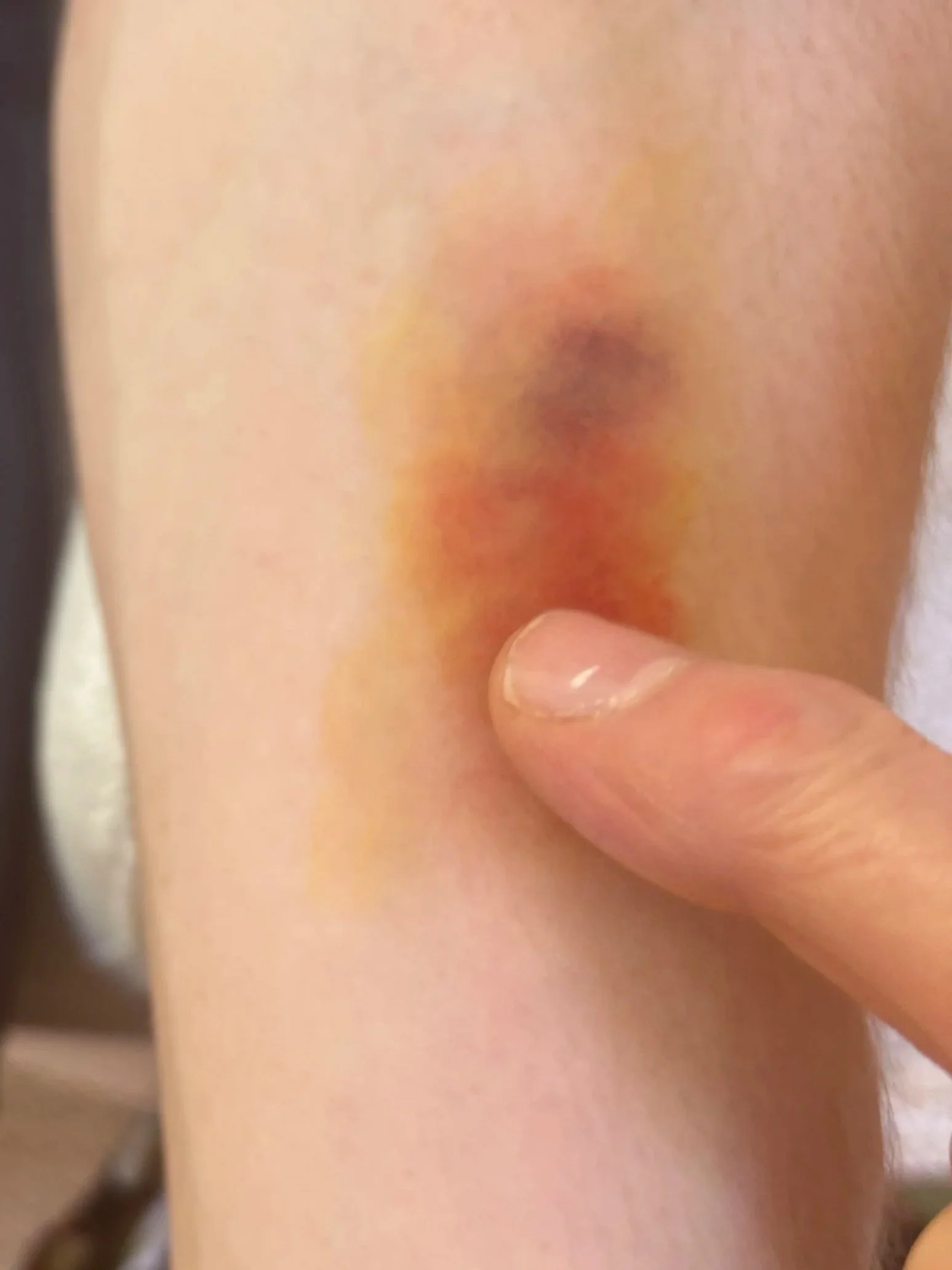 PROCESS: Basic FX - Bruise