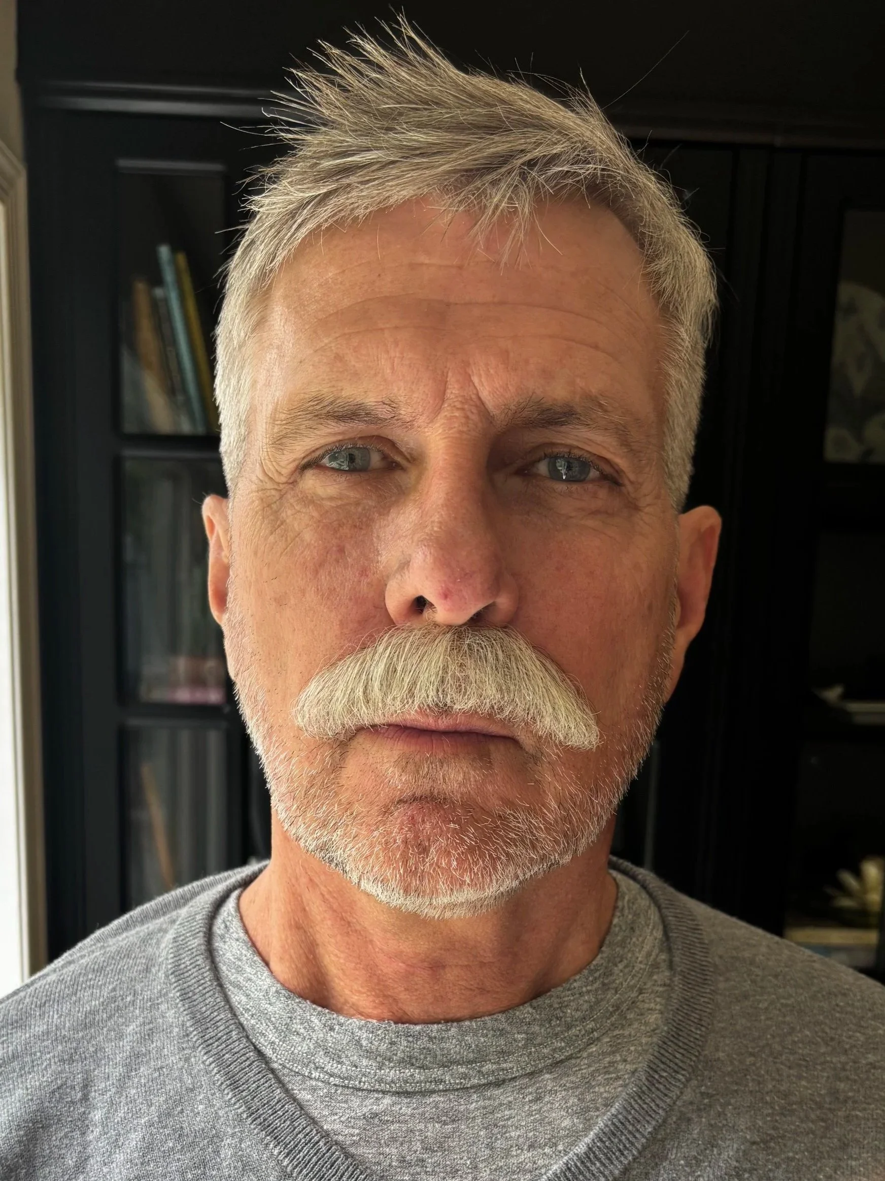 AFTER / FRONT: Facial Hair - Lace Piece Application