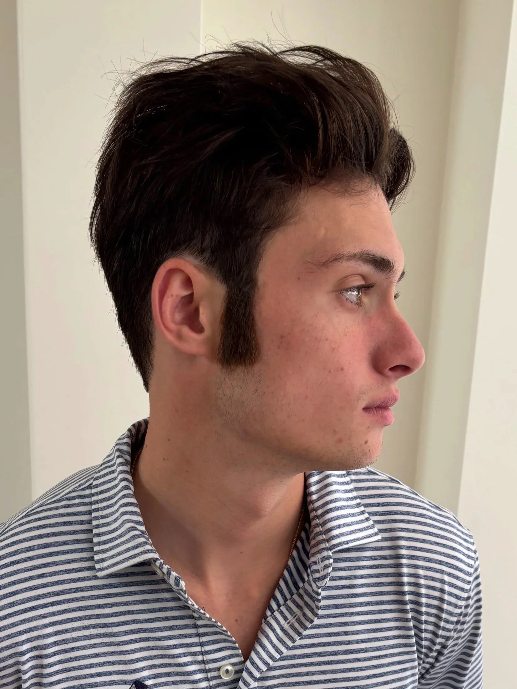 AFTER / RIGHT: Facial Hair - Hand-Laid Facial Hair