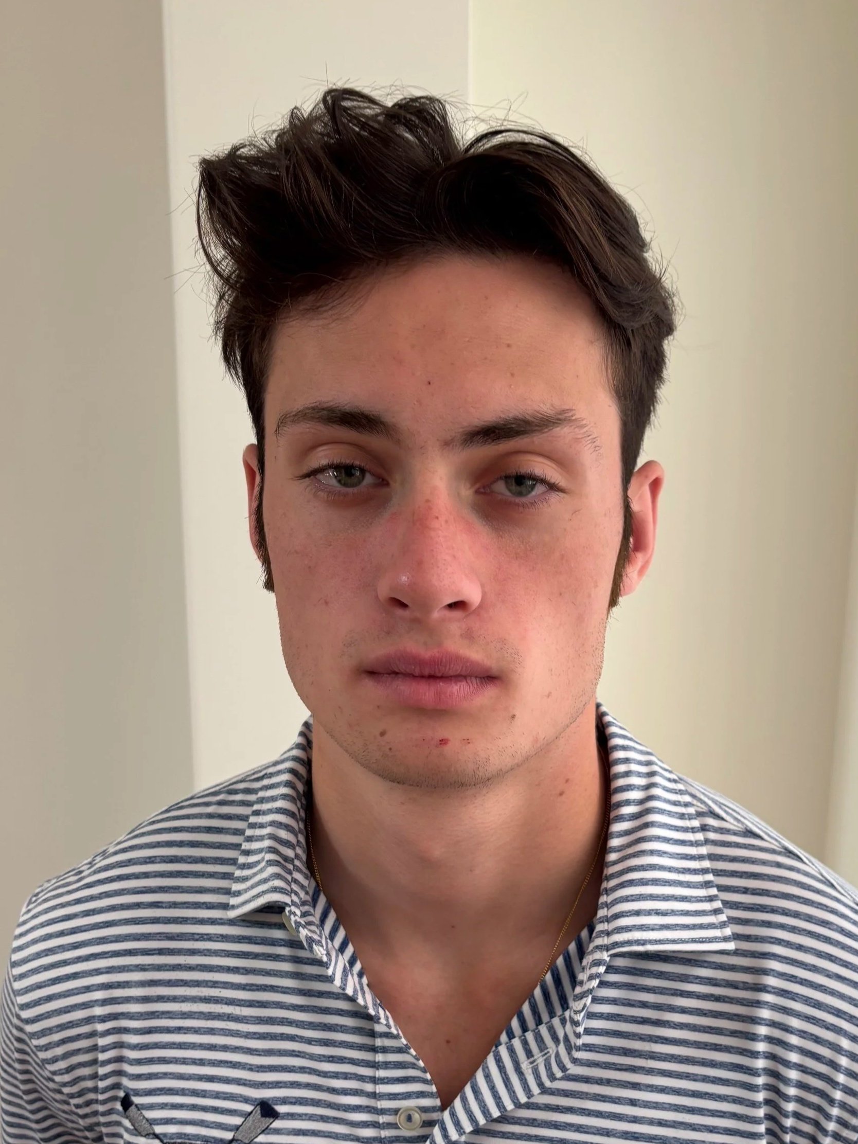 AFTER / FRONT: Facial Hair - Hand-Laid Facial Hair