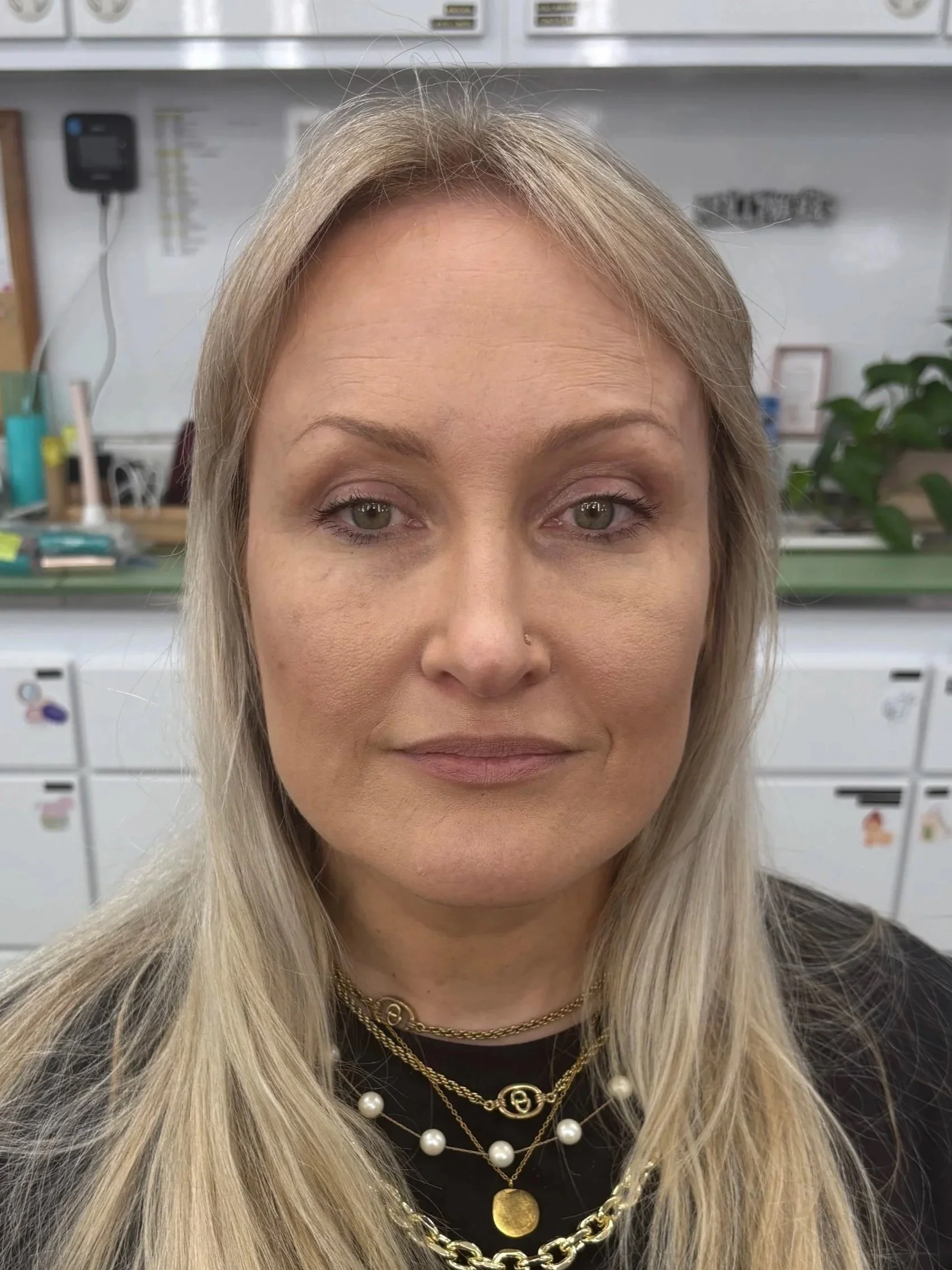 AFTER / FRONT: Straight & Corrective - Look 2