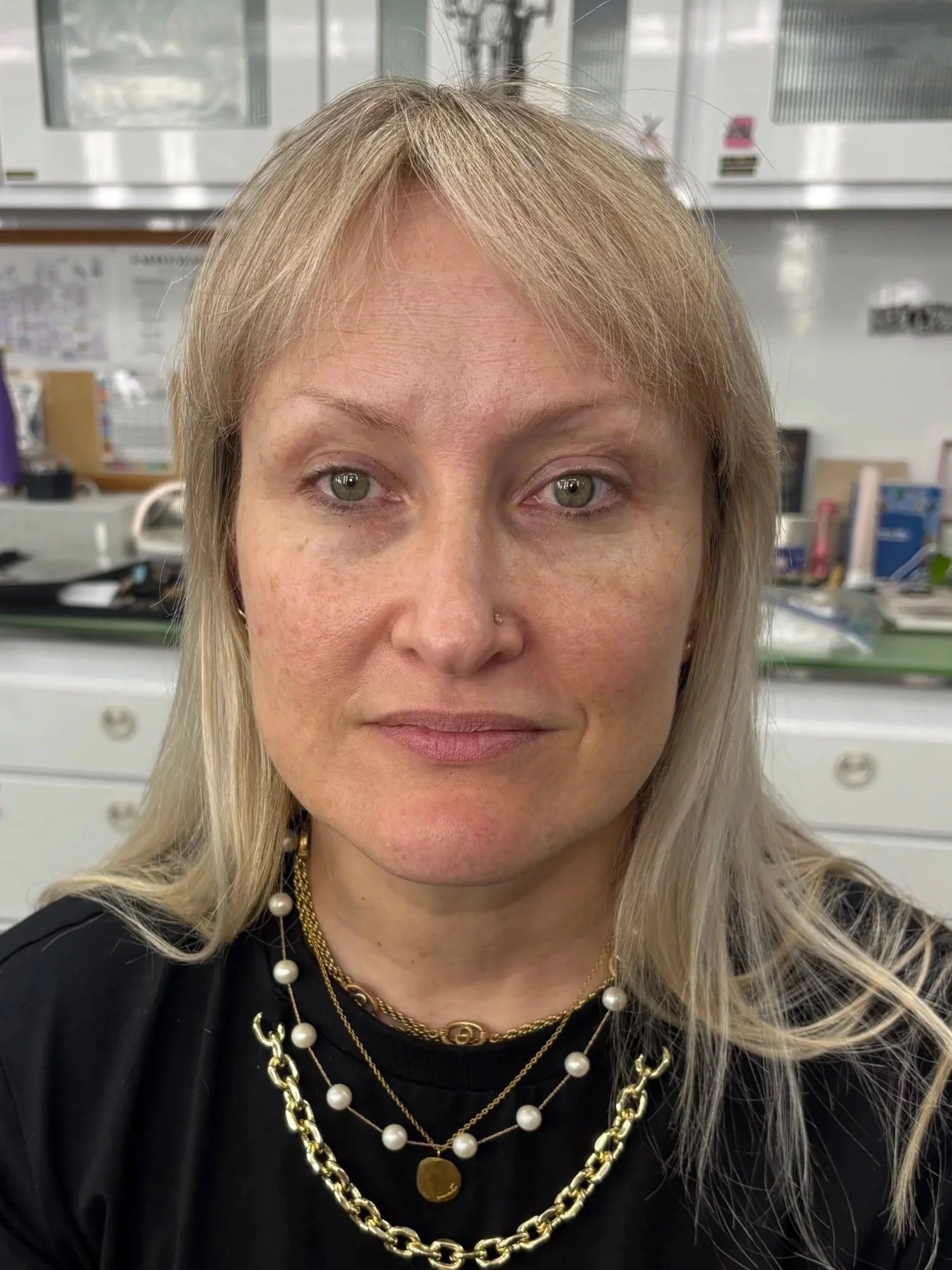 BEFORE: Straight & Corrective - Look 2