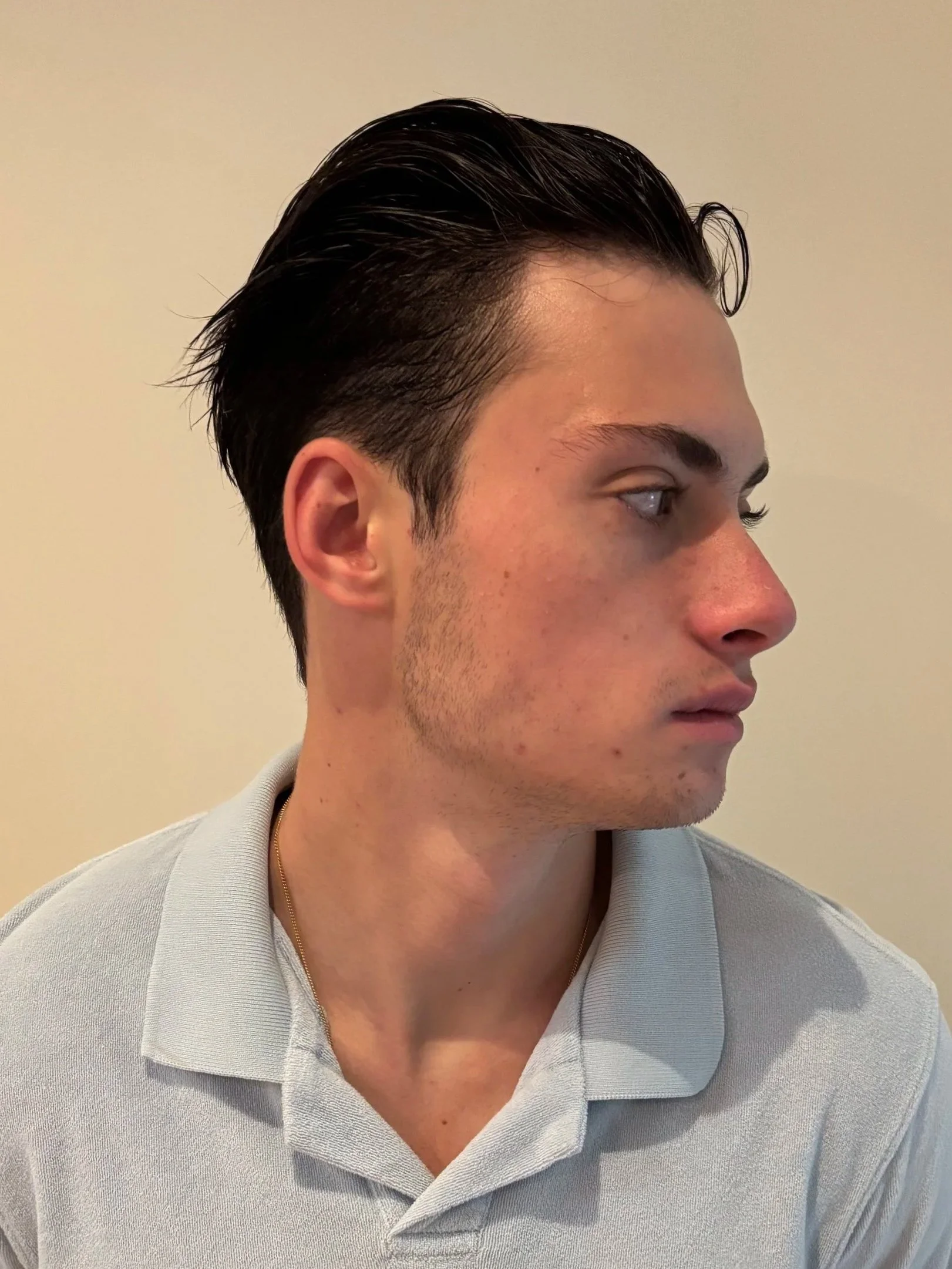 BEFORE: Character - Look 2 - Zombie