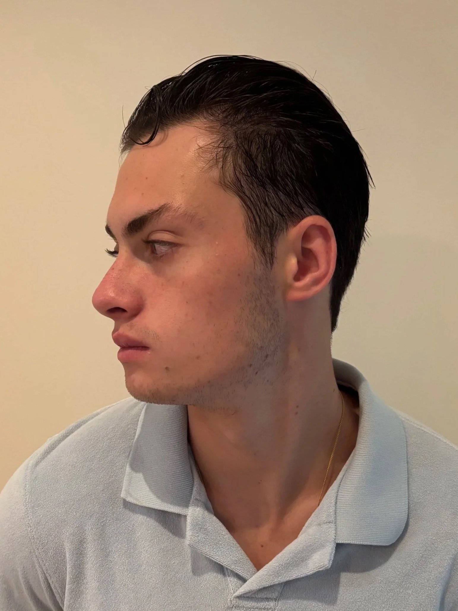 BEFORE: Character - Look 2 - Zombie