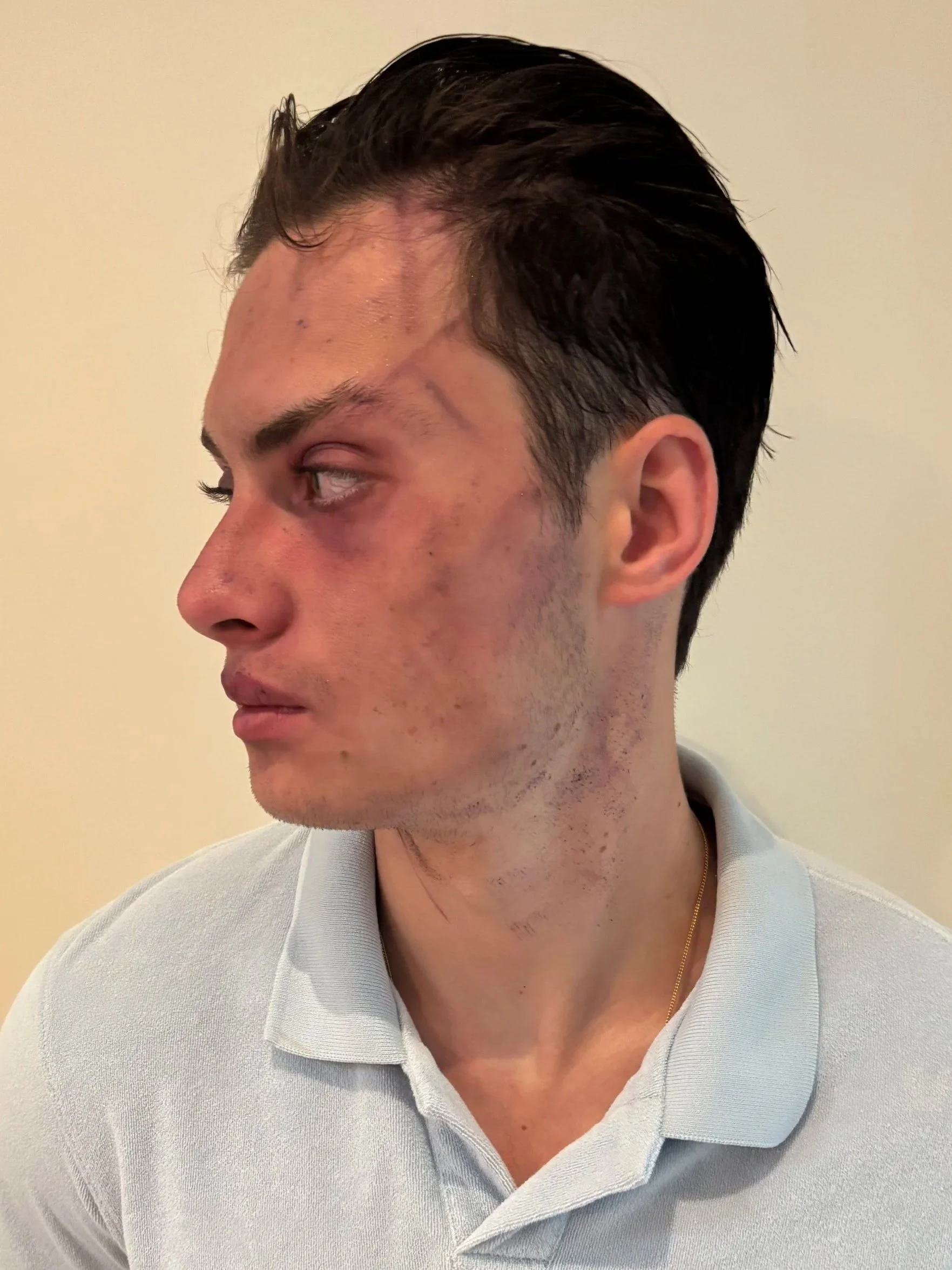 AFTER / LEFT: Character - Look 2 - Zombie