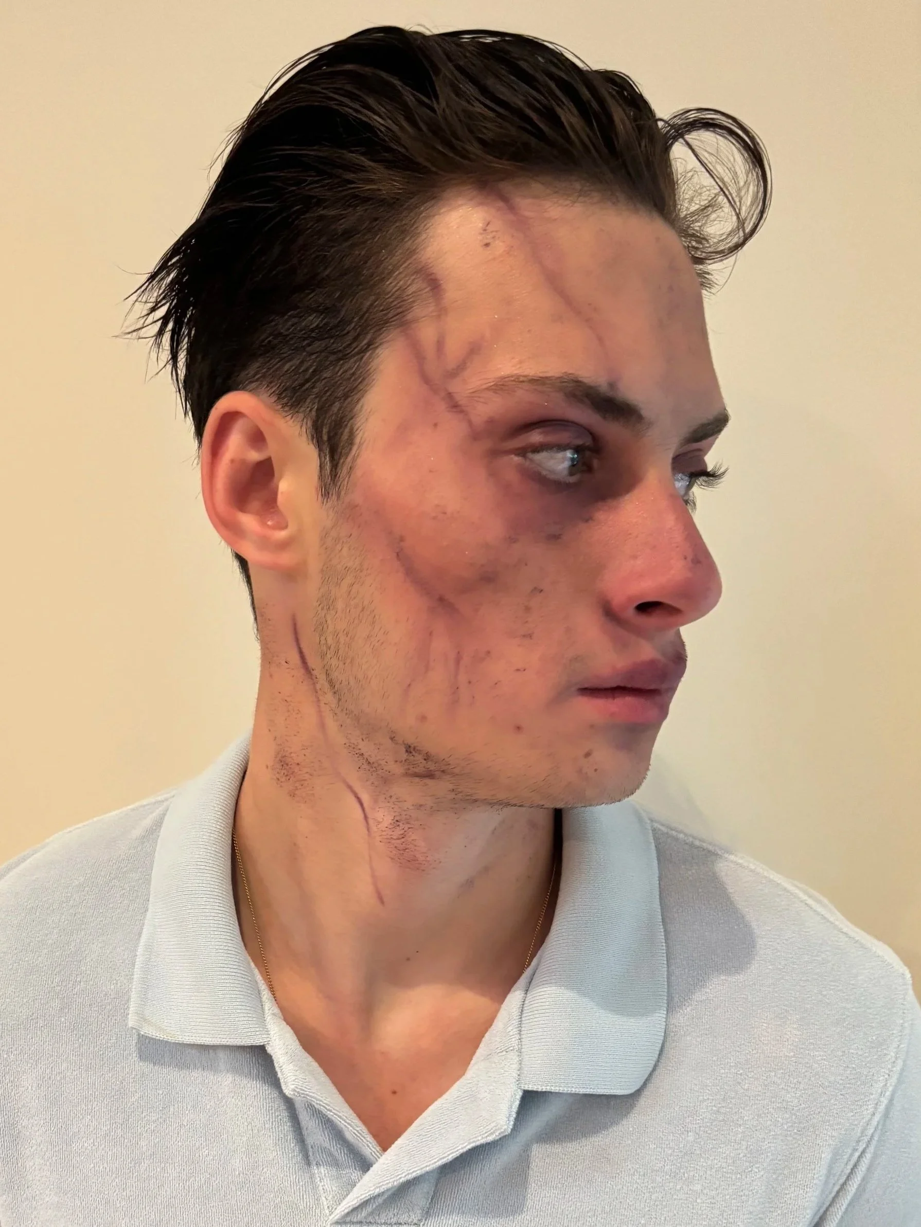 AFTER / RIGHT: Character - Look 2 - Zombie
