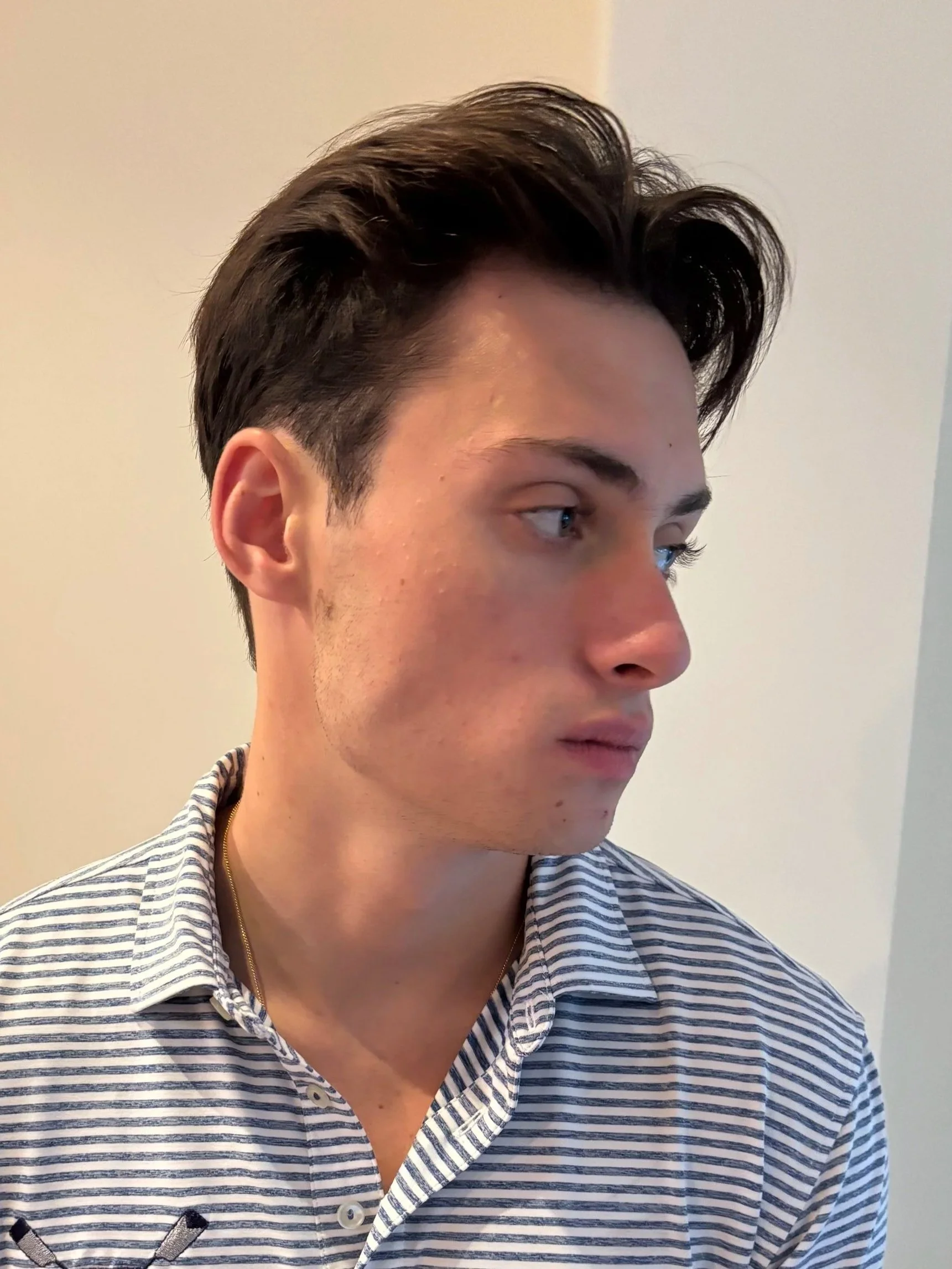 BEFORE: Facial Hair - Hand-Laid Facial Hair