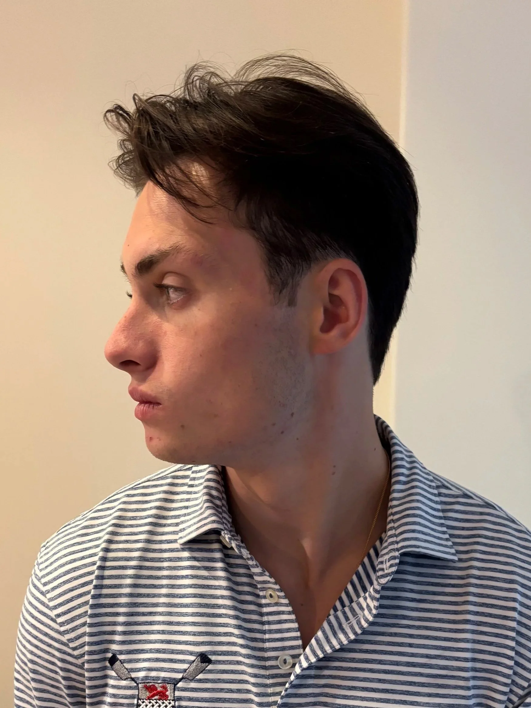 BEFORE: Facial Hair - Hand-Laid Facial Hair