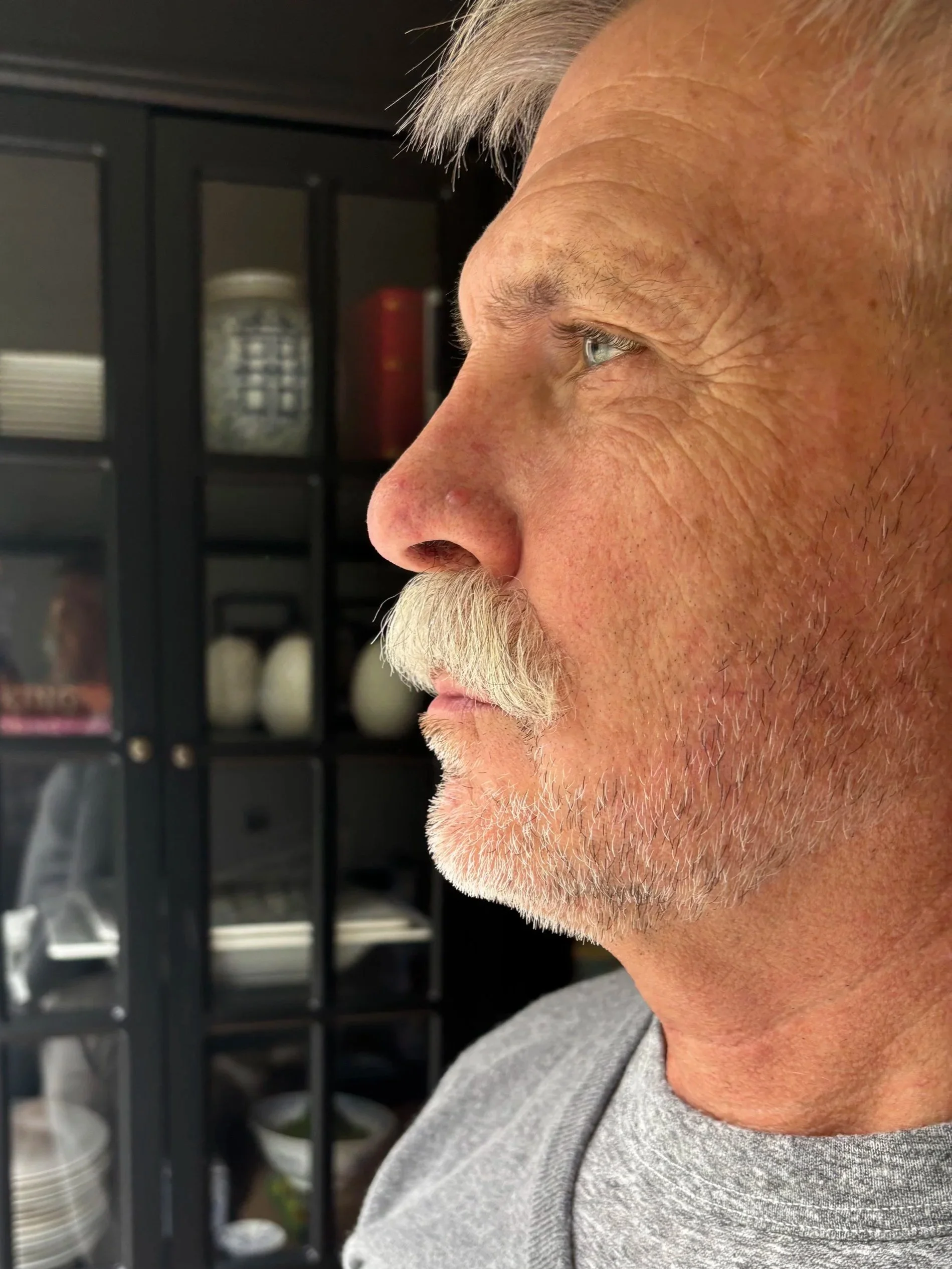 AFTER / LEFT: Facial Hair - Lace Piece Application
