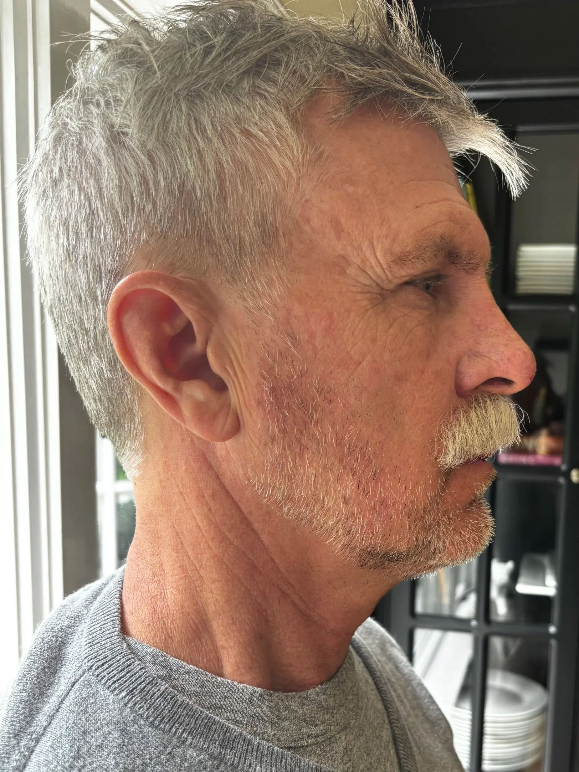 AFTER / RIGHT: Facial Hair - Lace Piece Application