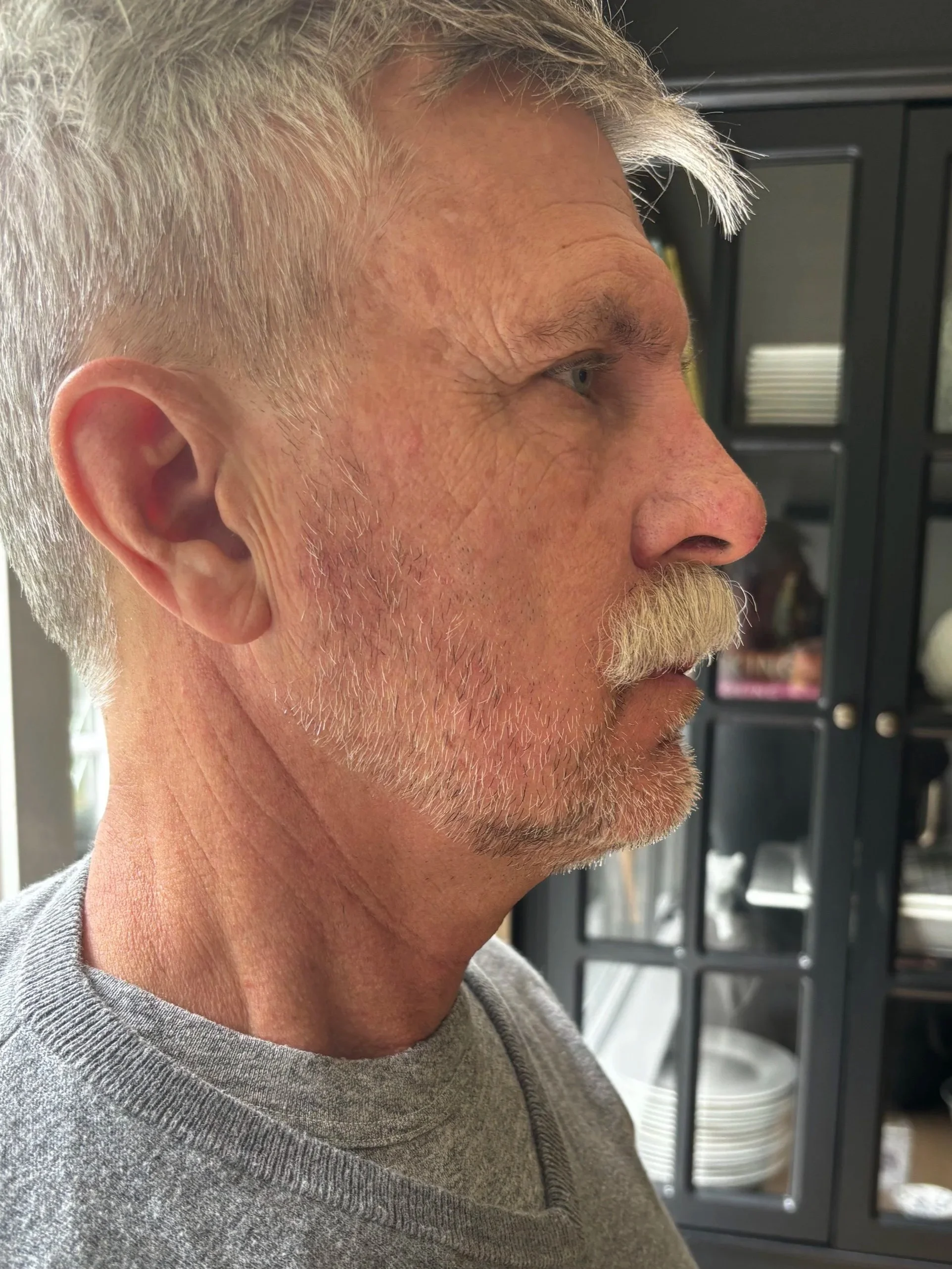 AFTER / RIGHT: Facial Hair - Lace Piece Application