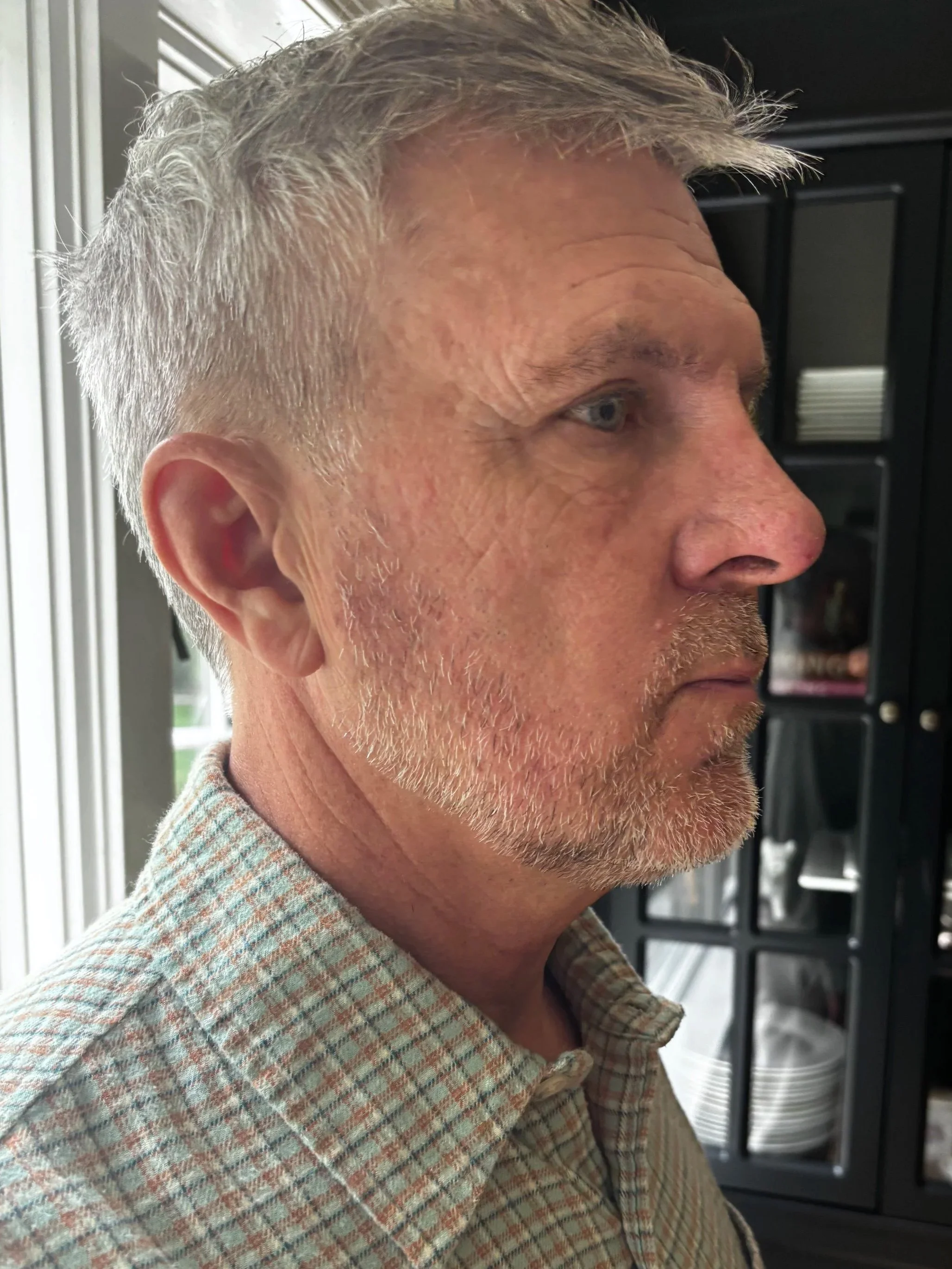 BEFORE: Facial Hair - Lace Piece Application
