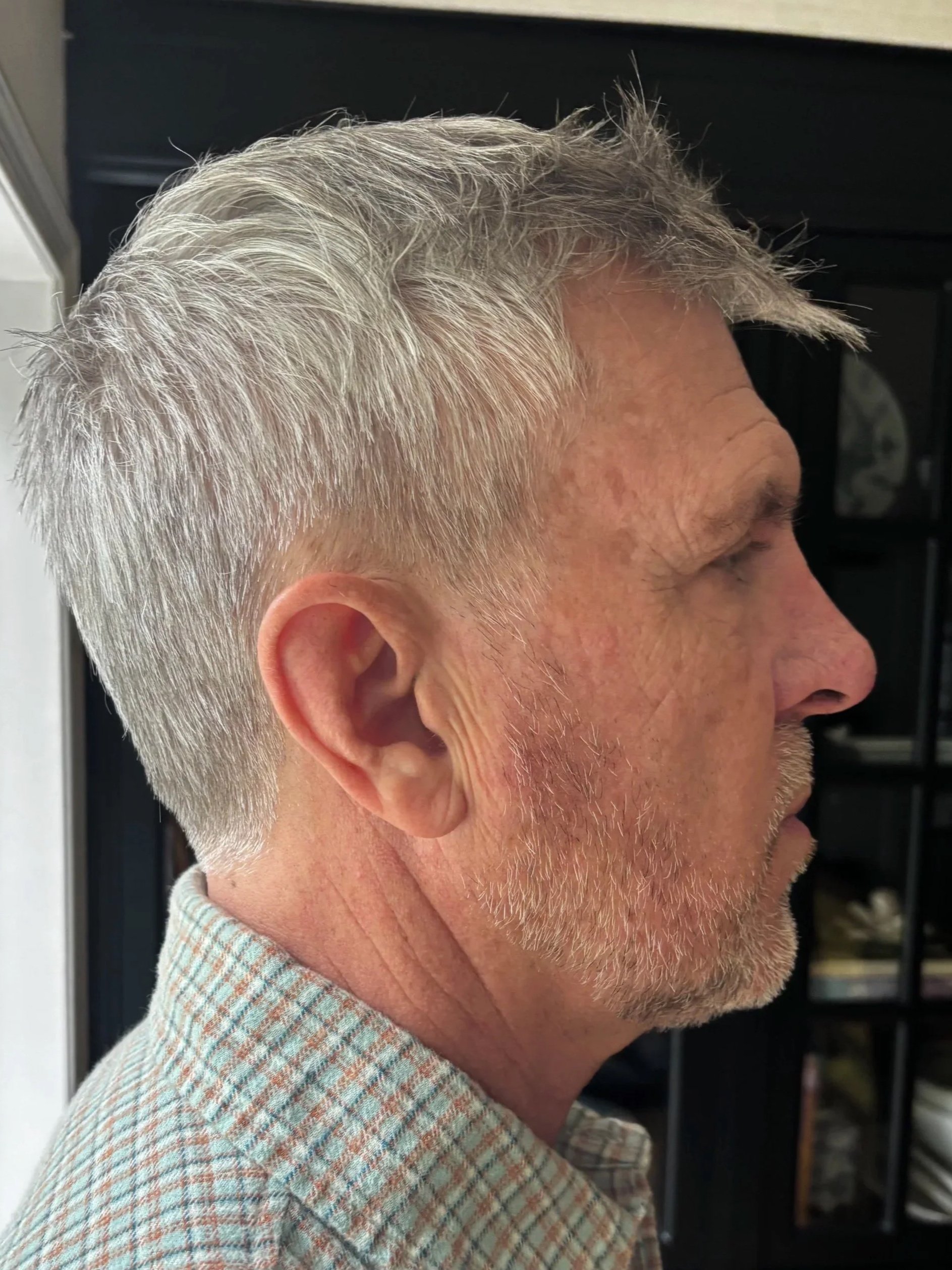BEFORE: Facial Hair - Lace Piece Application
