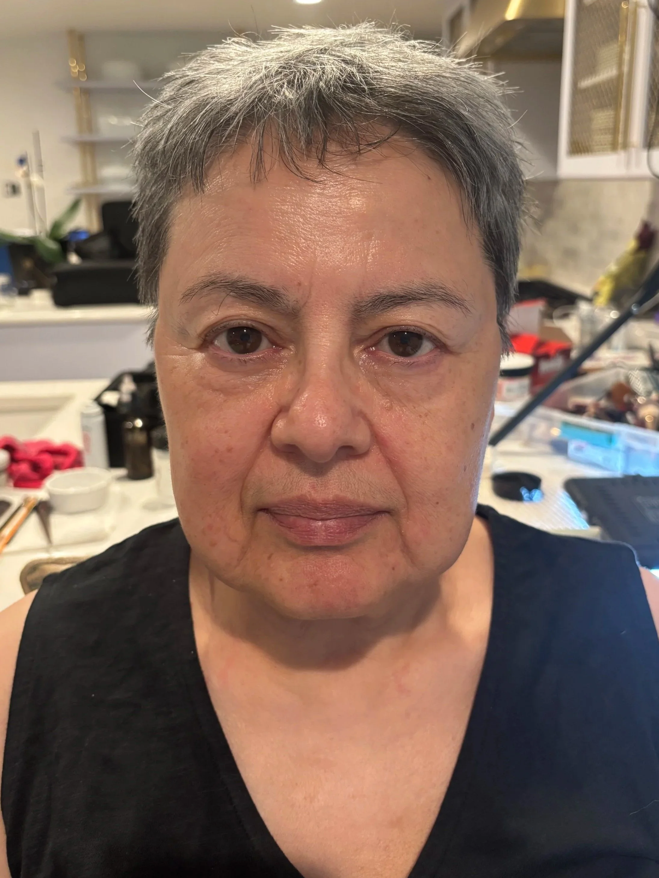 BEFORE: Aging - Stretch/Stipple - Age 55 to 65