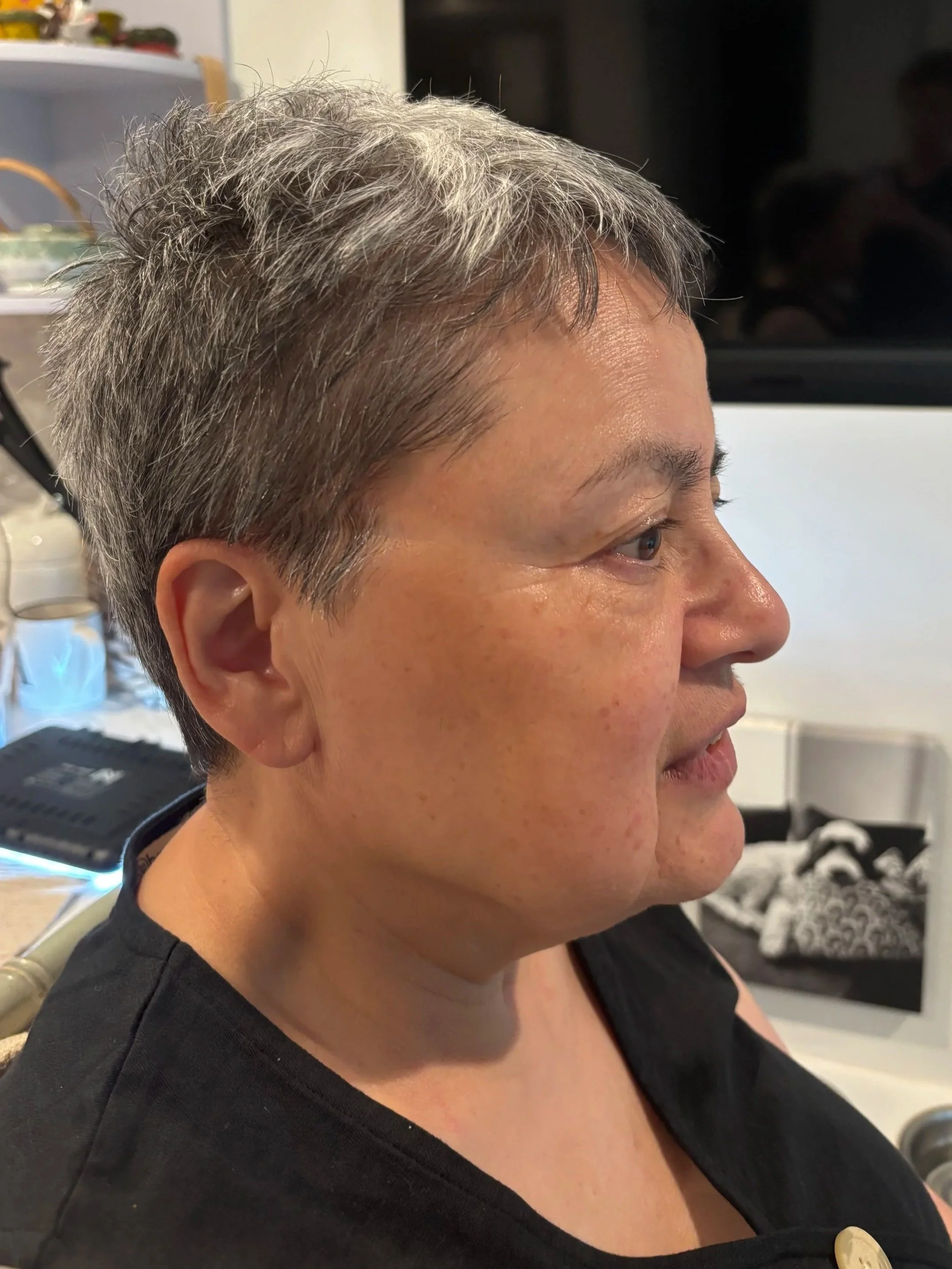 BEFORE: Aging - Stretch/Stipple - Age 55 to 65