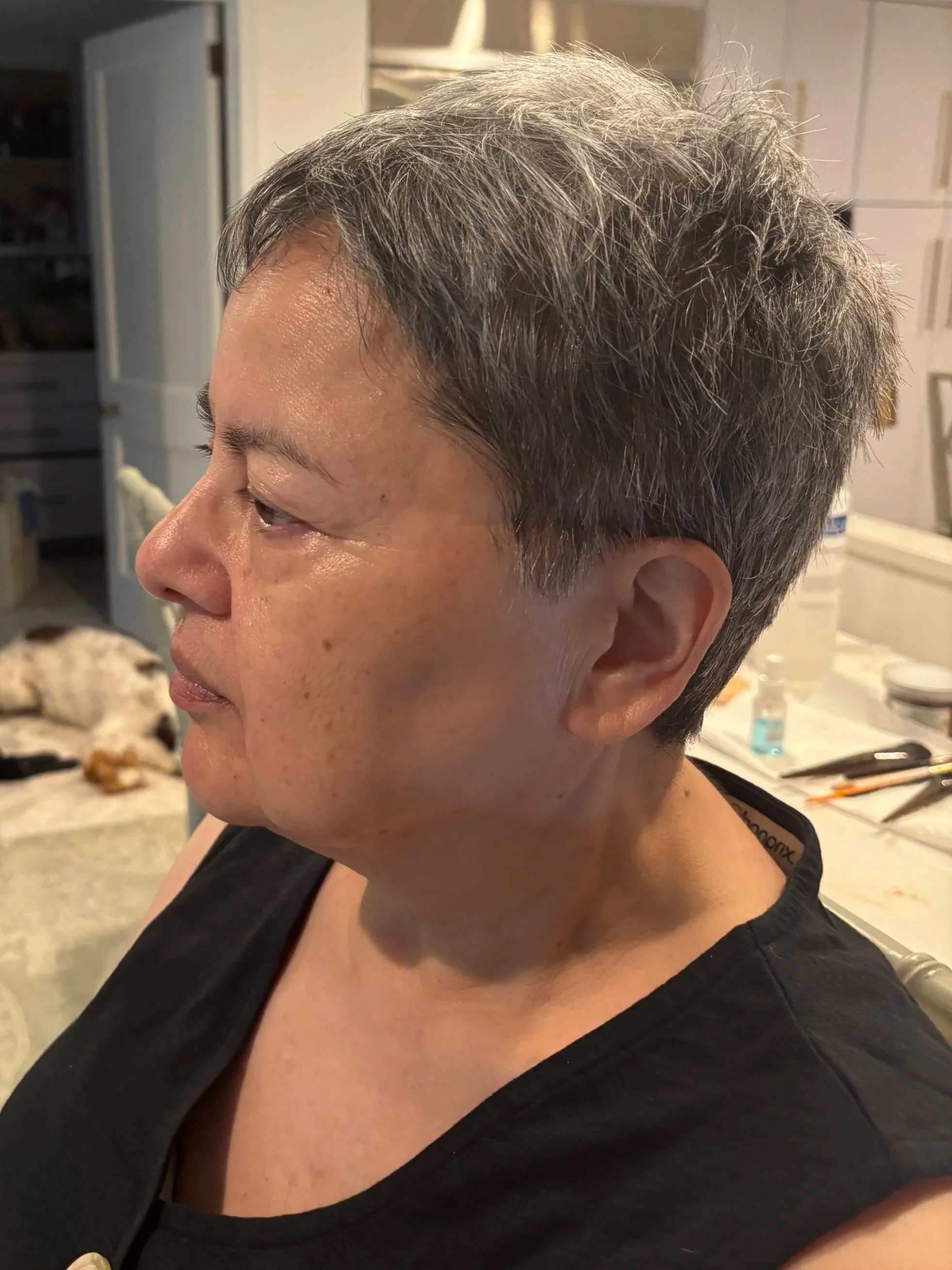 BEFORE: Aging - Stretch/Stipple - Age 55 to 65