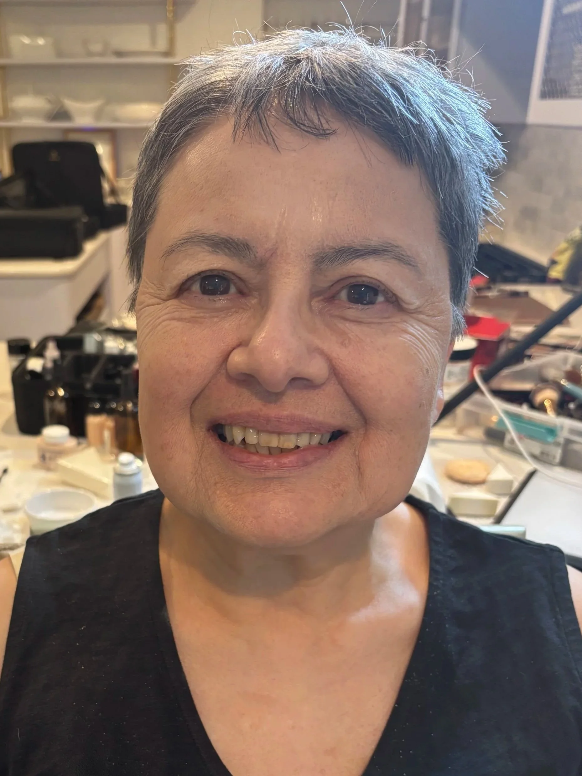 AFTER / FRONT: Aging - Stretch/Stipple - Age 55 to 65