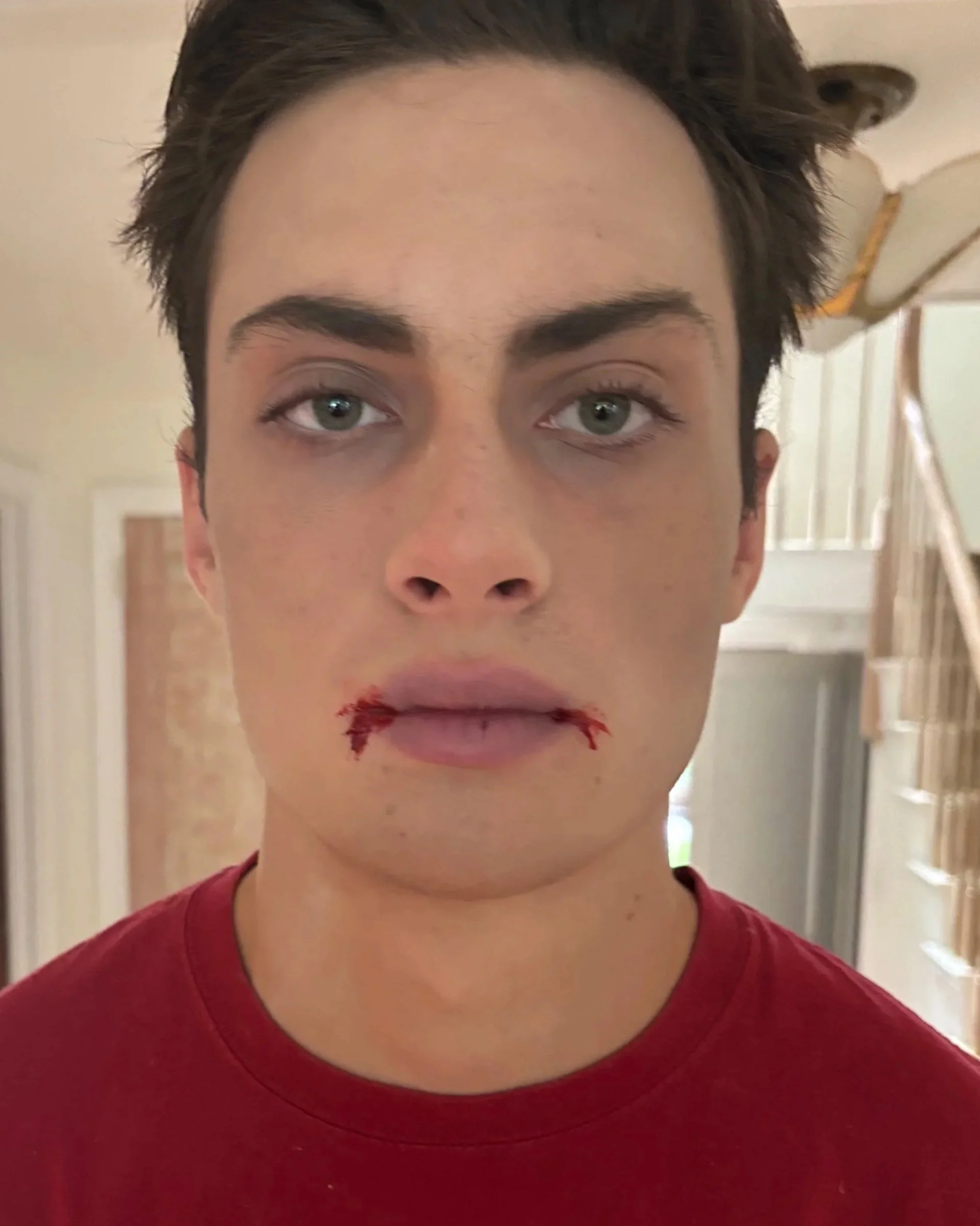 AFTER / FRONT: Character - Look 1 - Vampire