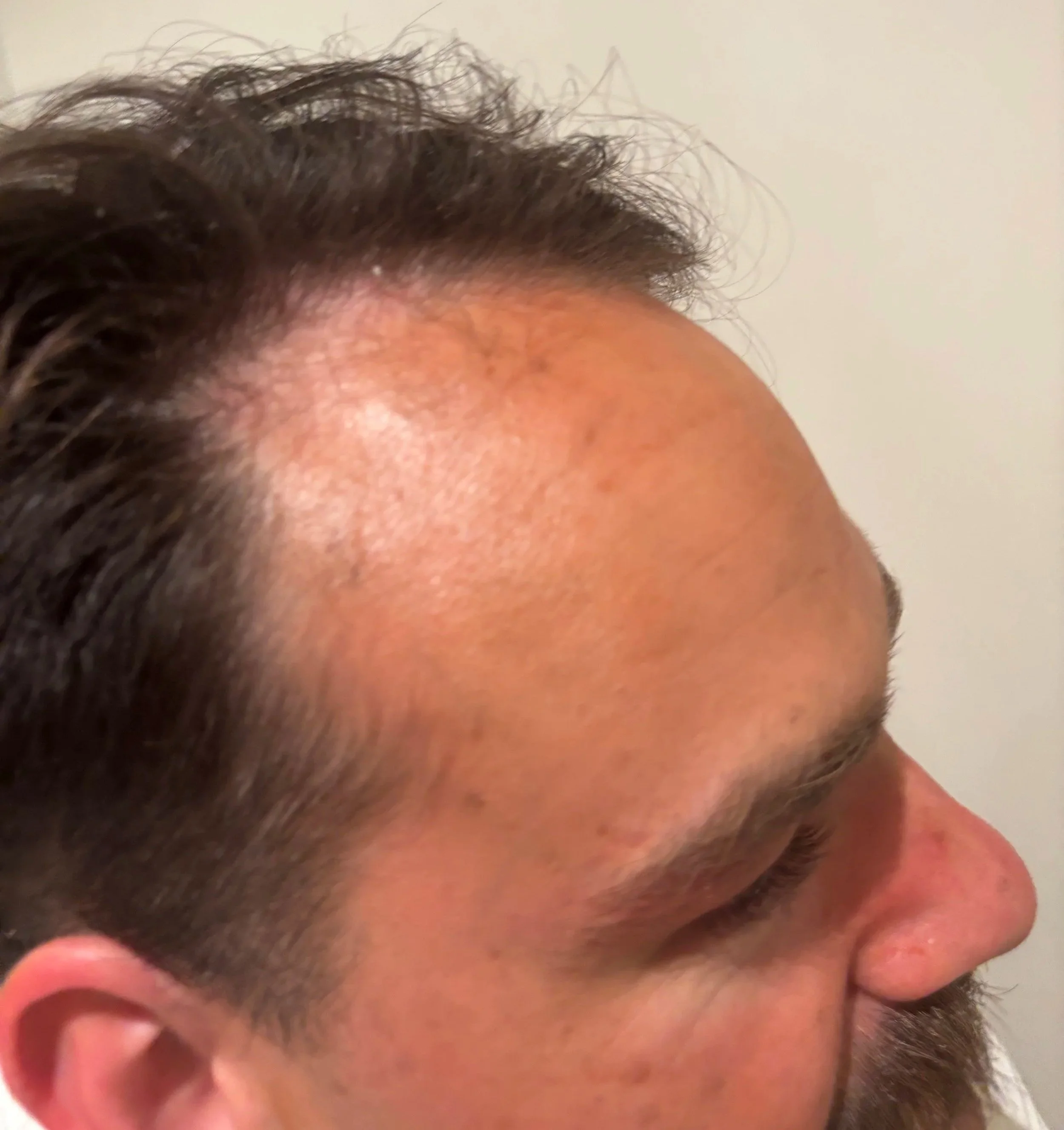 AFTER / RIGHT: Distress & Weathering - Sun/Hot Weather Exposure