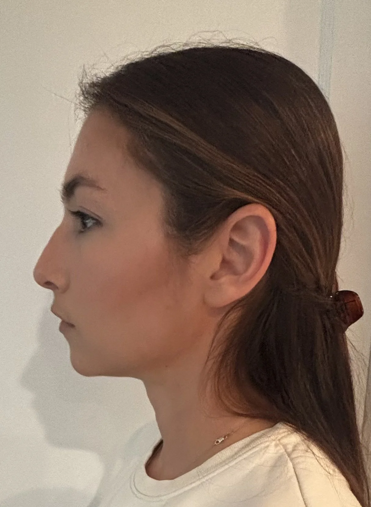 AFTER / LEFT: Straight & Corrective - Look 1