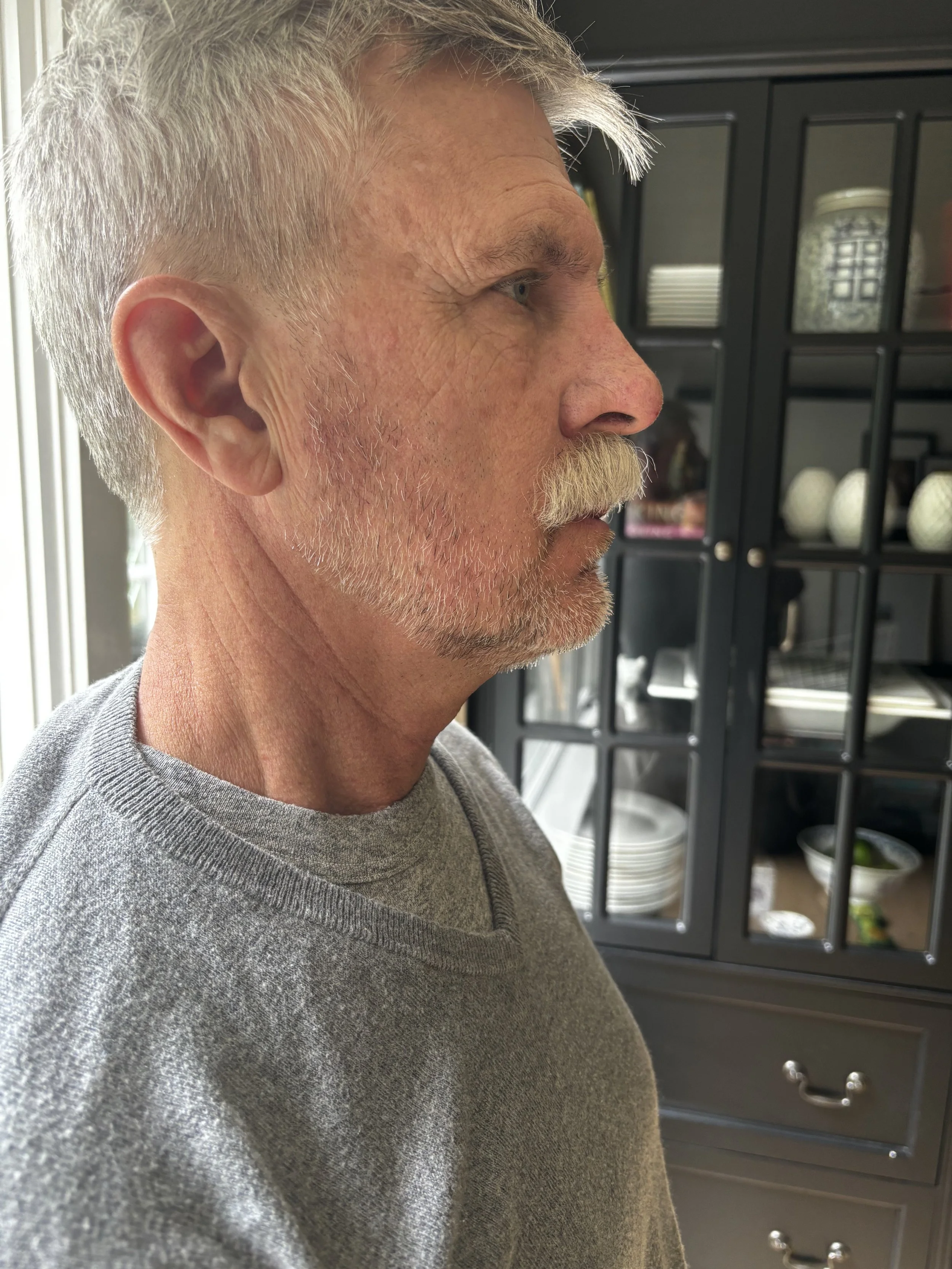 AFTER: Facial Hair - Lace Piece Application