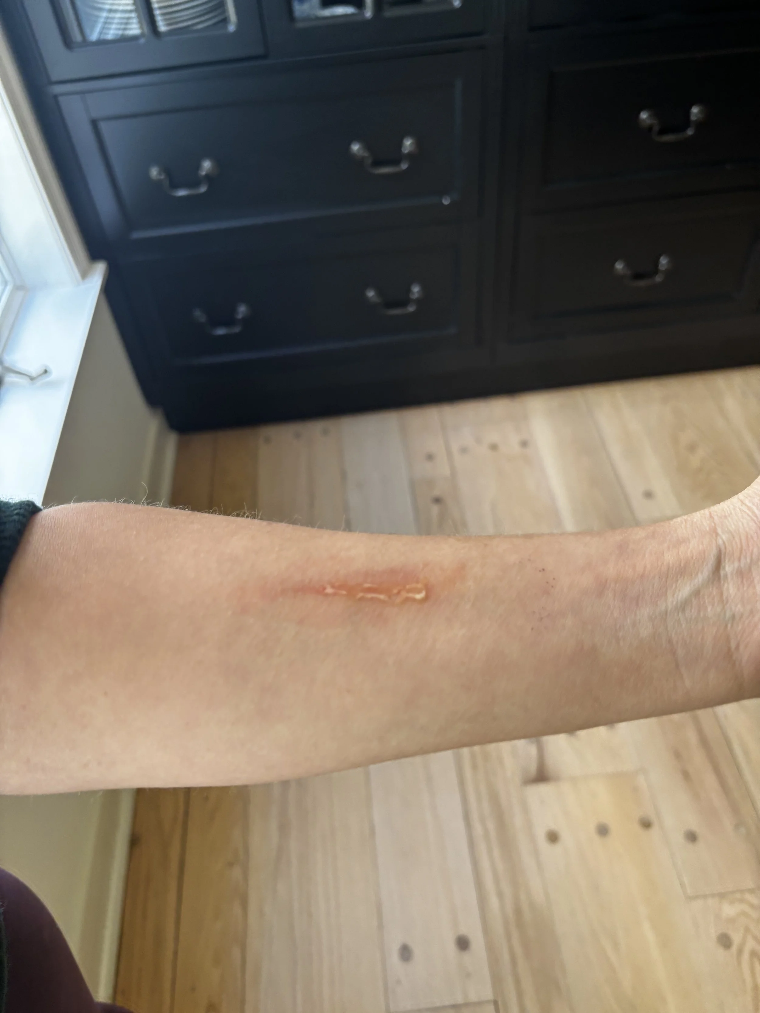 AFTER: Basic FX - Blister