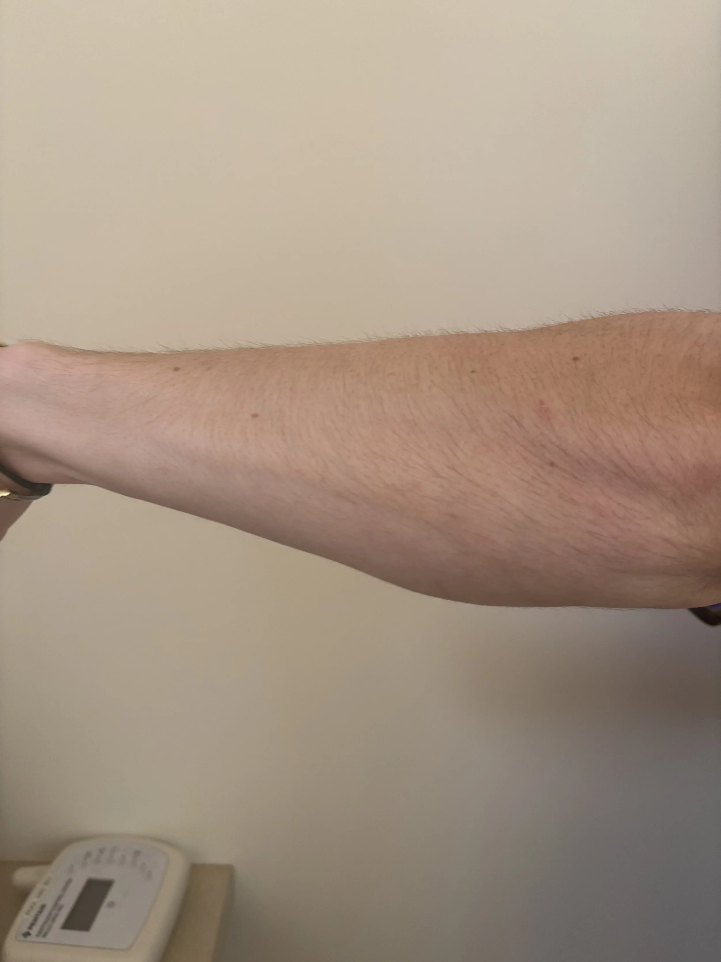 BEFORE: Basic FX - Bruise
