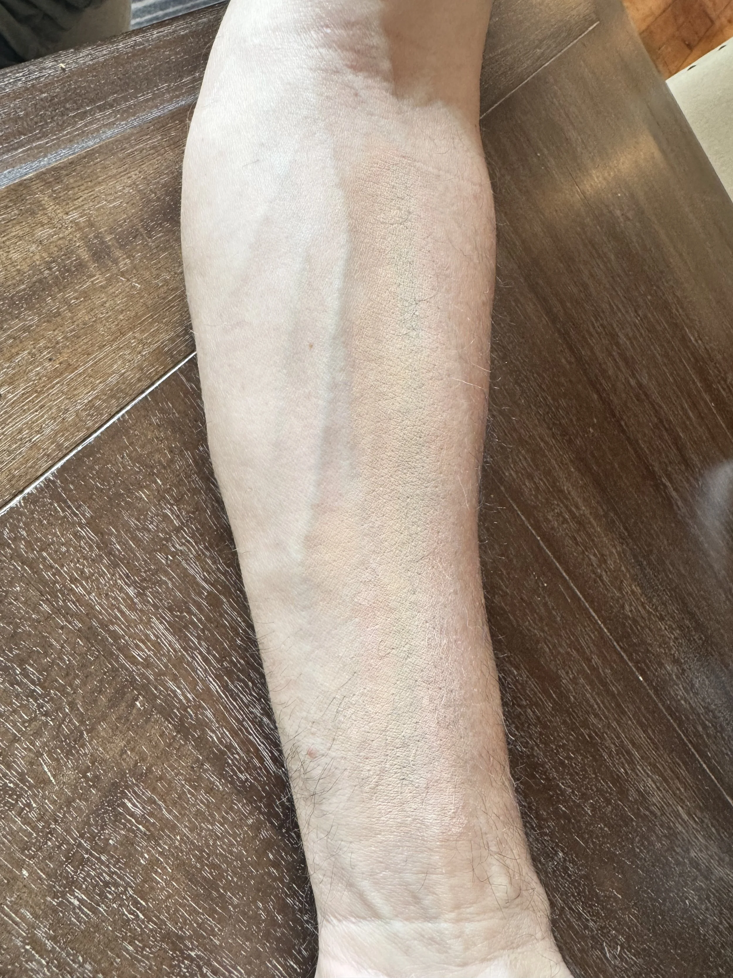 AFTER: Tattoos - Coverage