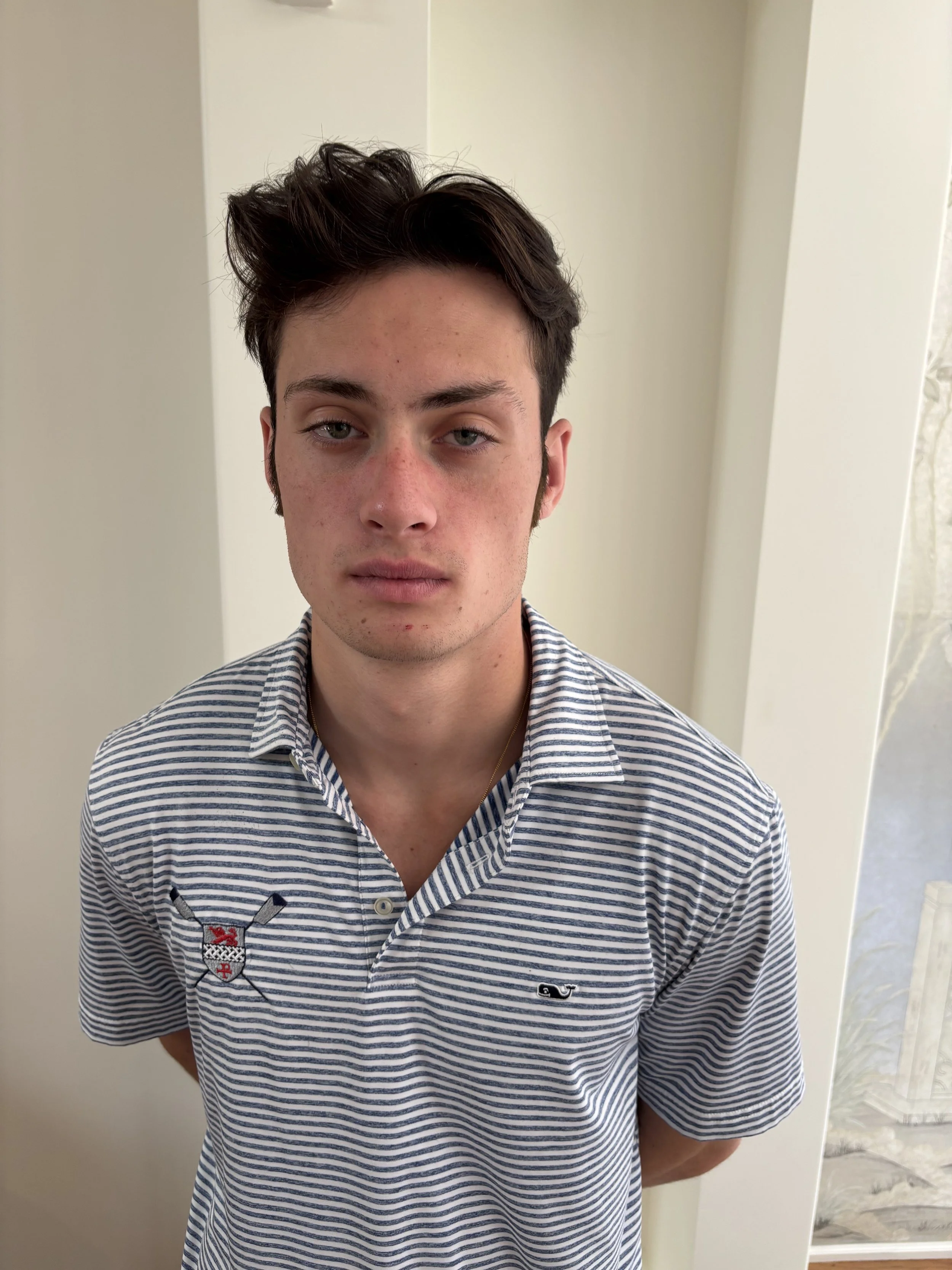 AFTER: Facial Hair - Hand-Laid Facial Hair