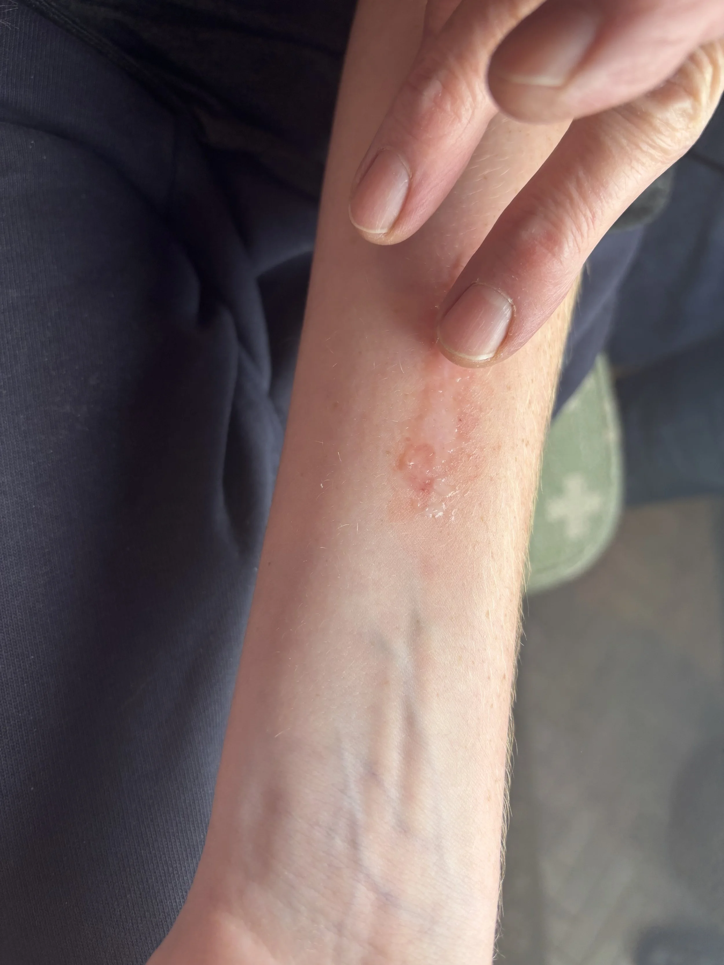 PROCESS: Basic FX - Burn