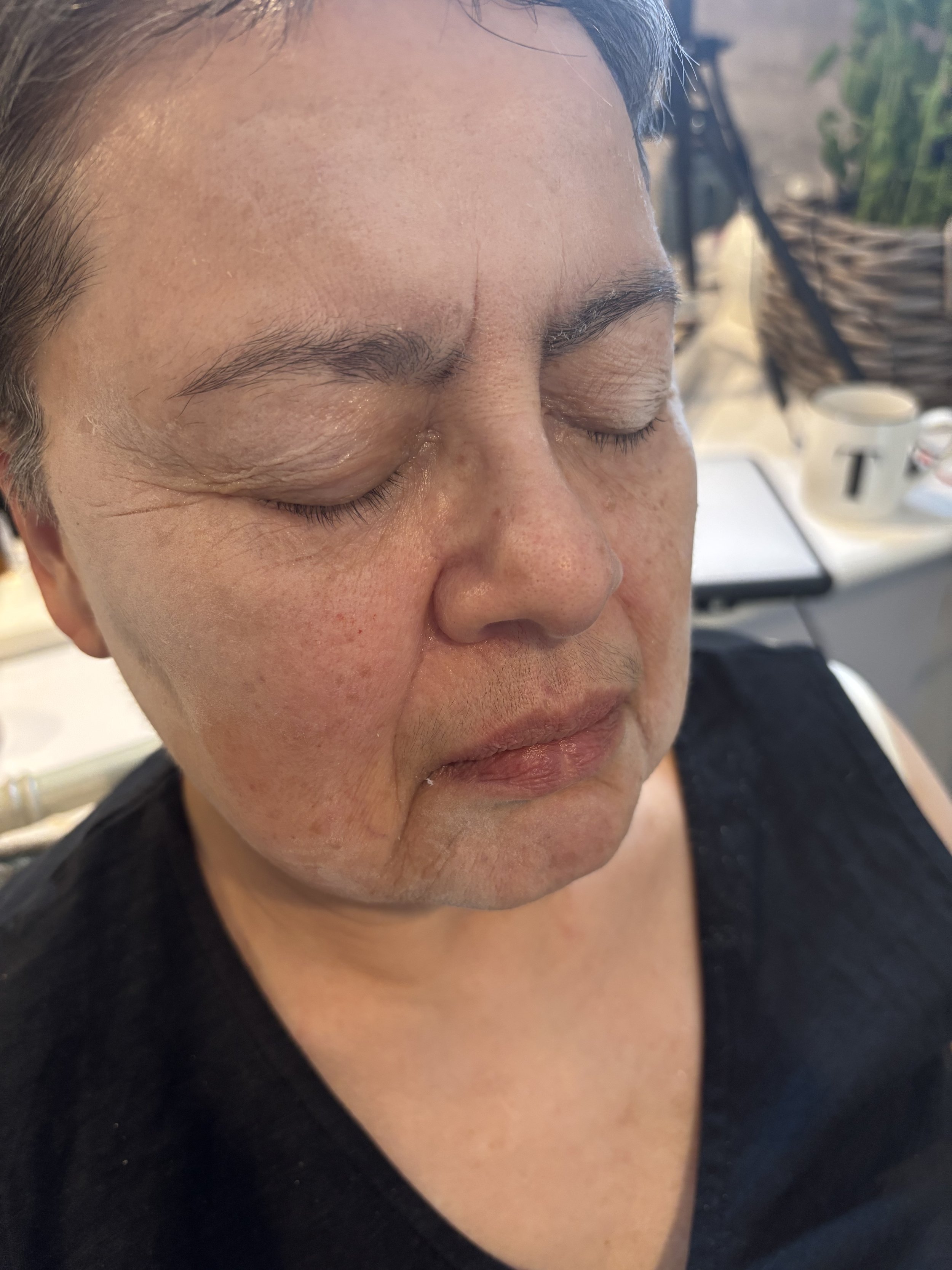 PROCESS: Aging - Stretch/Stipple - Age 55 to 65