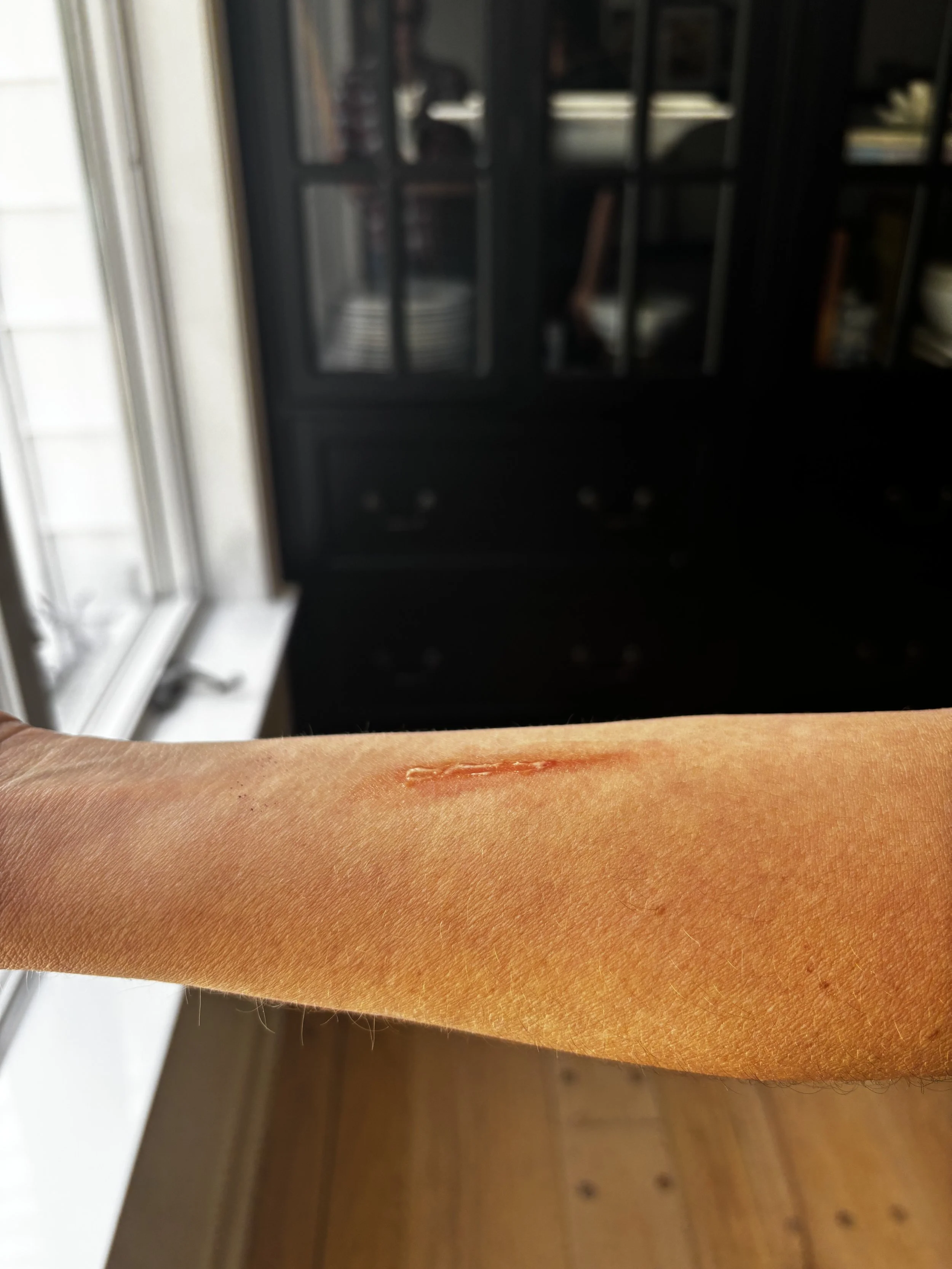 AFTER: Basic FX - Blister