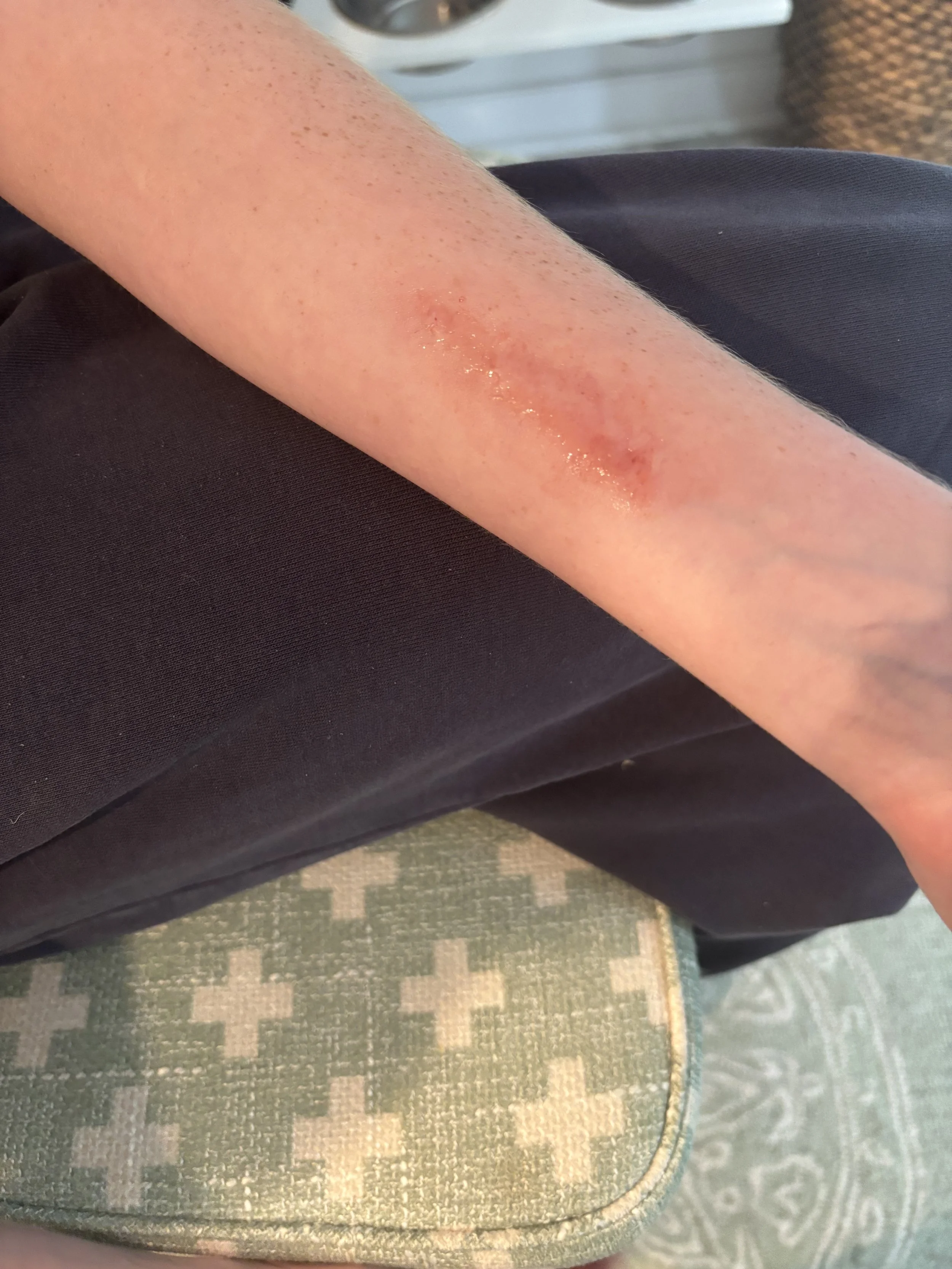 AFTER: Basic FX - Burn