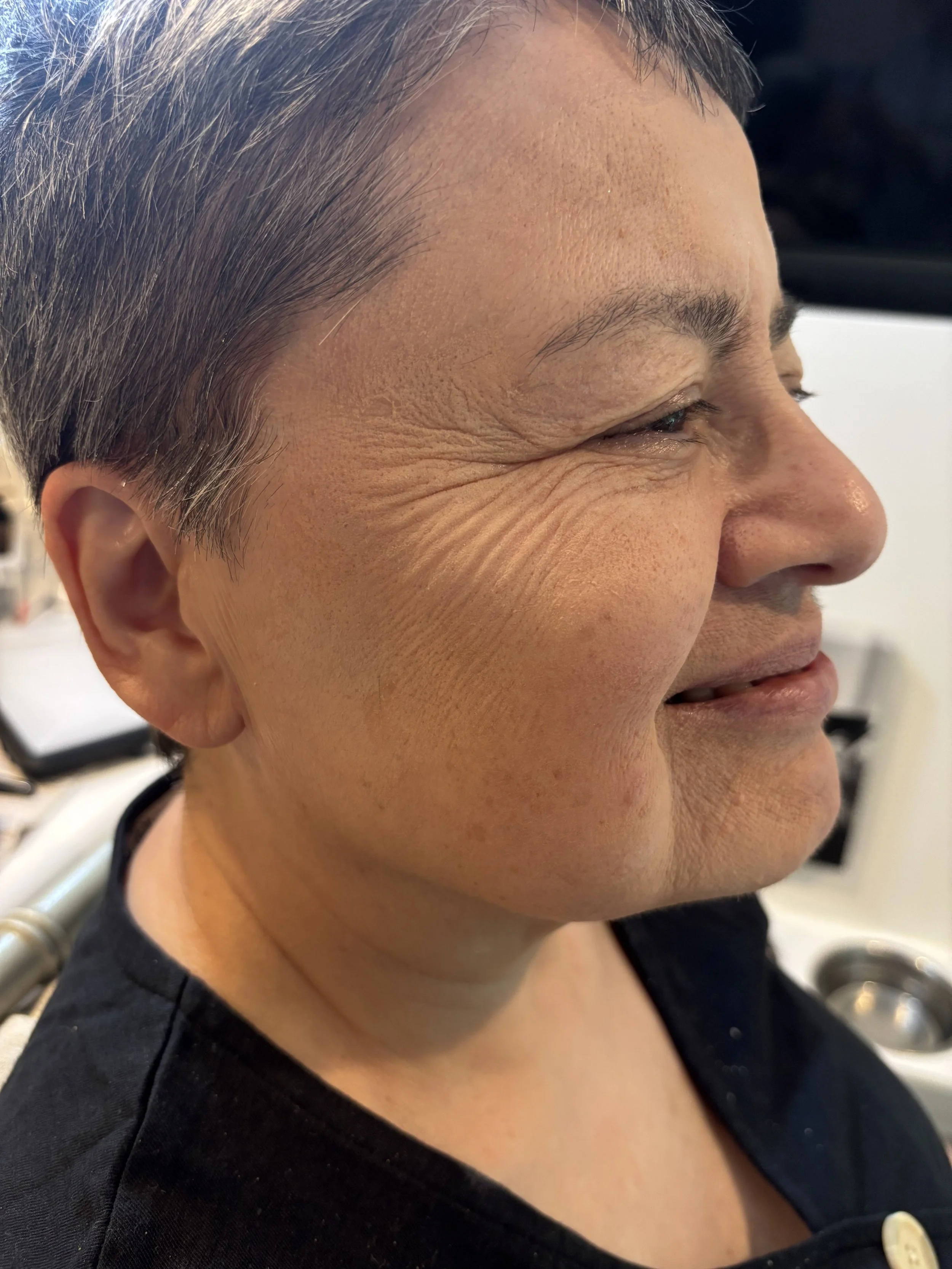 AFTER / RIGHT: Aging - Stretch/Stipple - Age 55 to 65