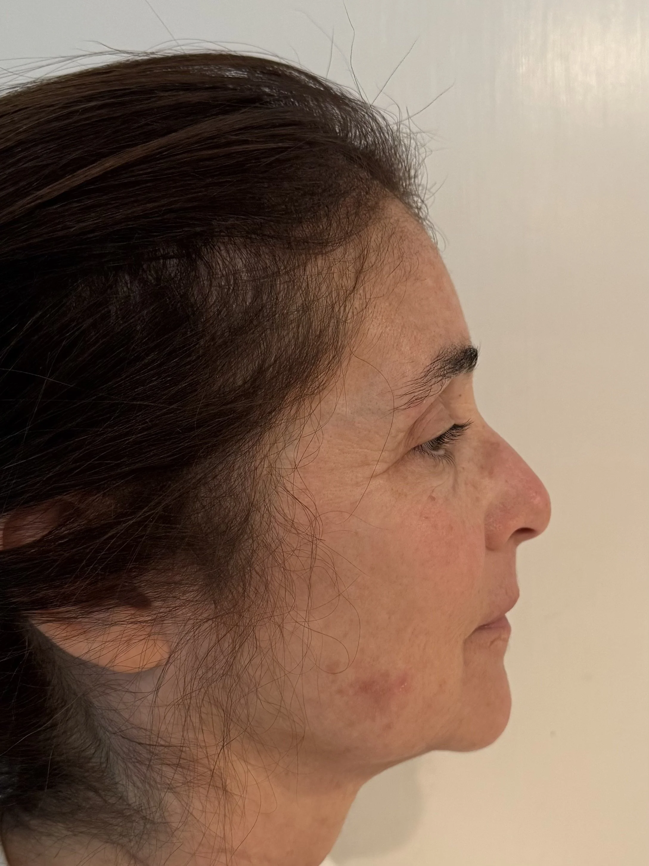 BEFORE: Aging - Highlight/Shadow