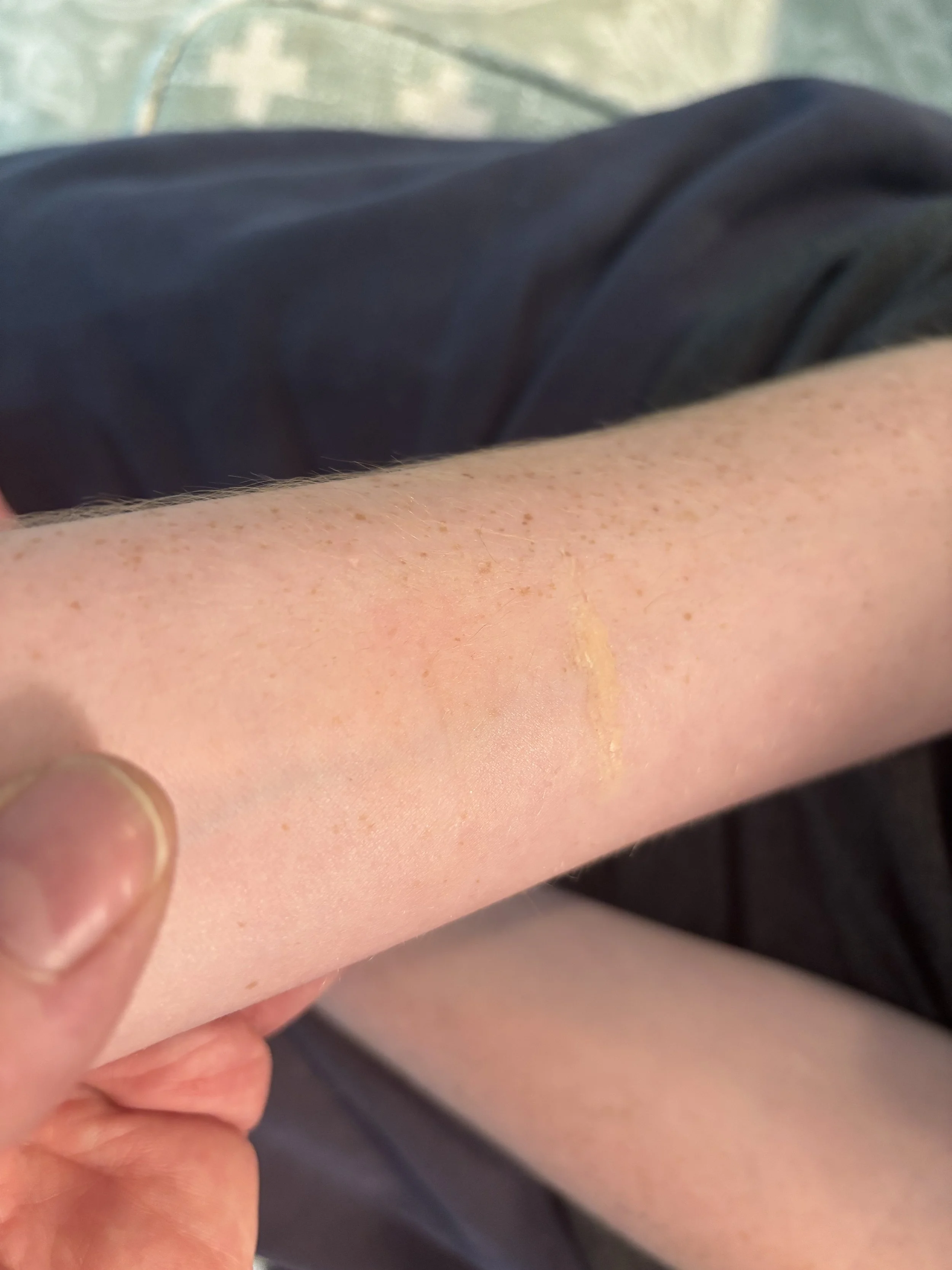 PROCESS: Basic FX - Scar 2